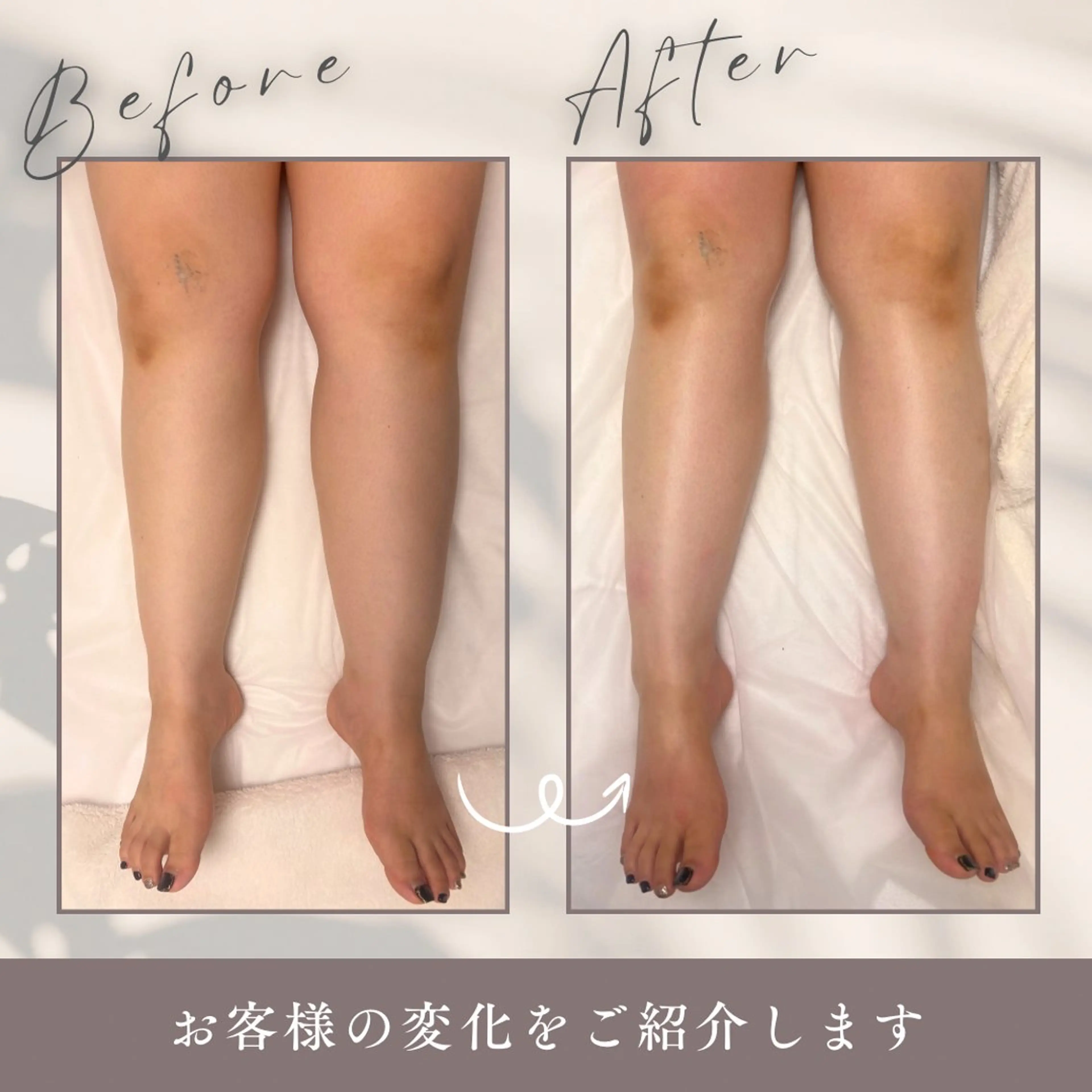 Lilas所属・迫原 麻衣のエステ・リラクイメージ