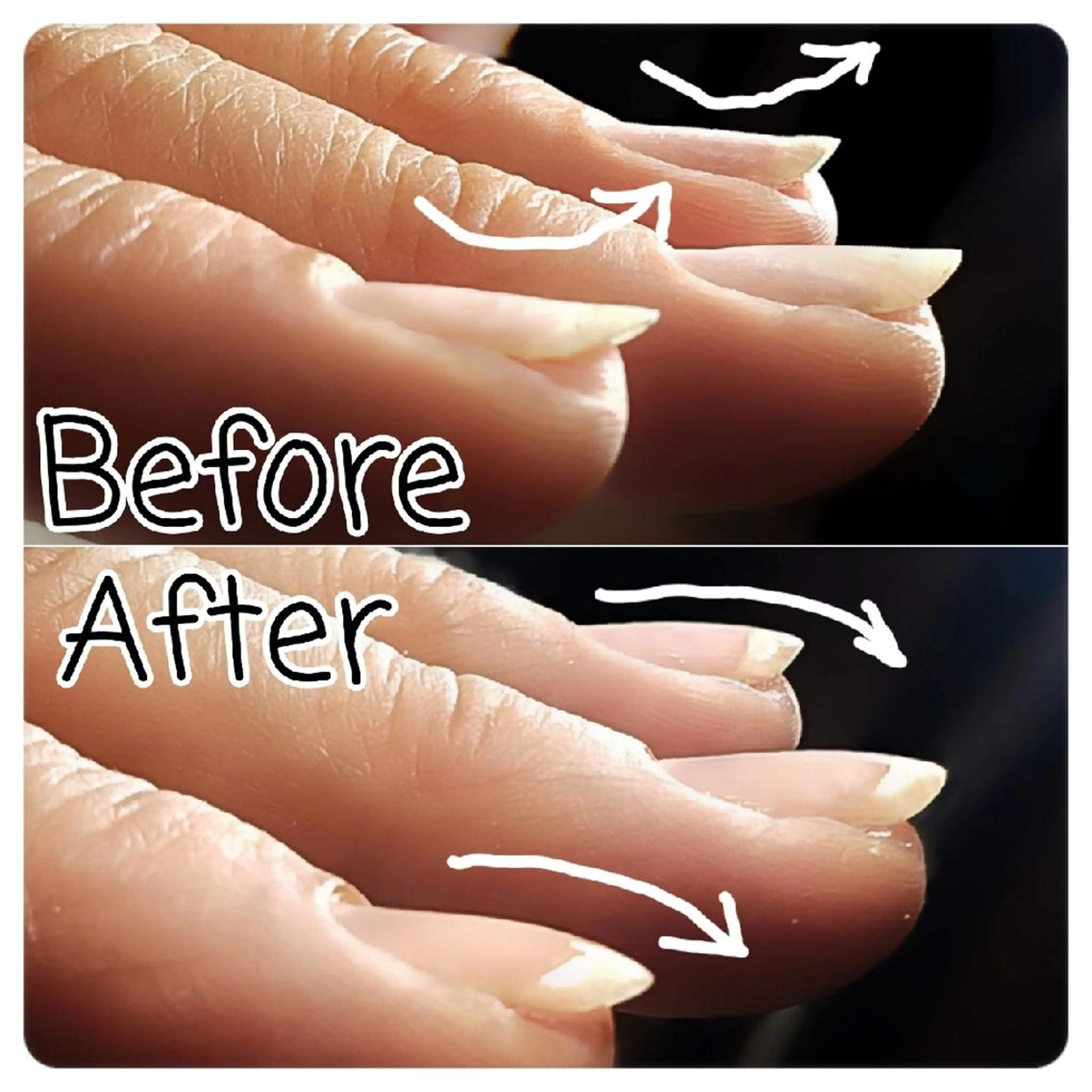 反り爪補正ジェルの写真