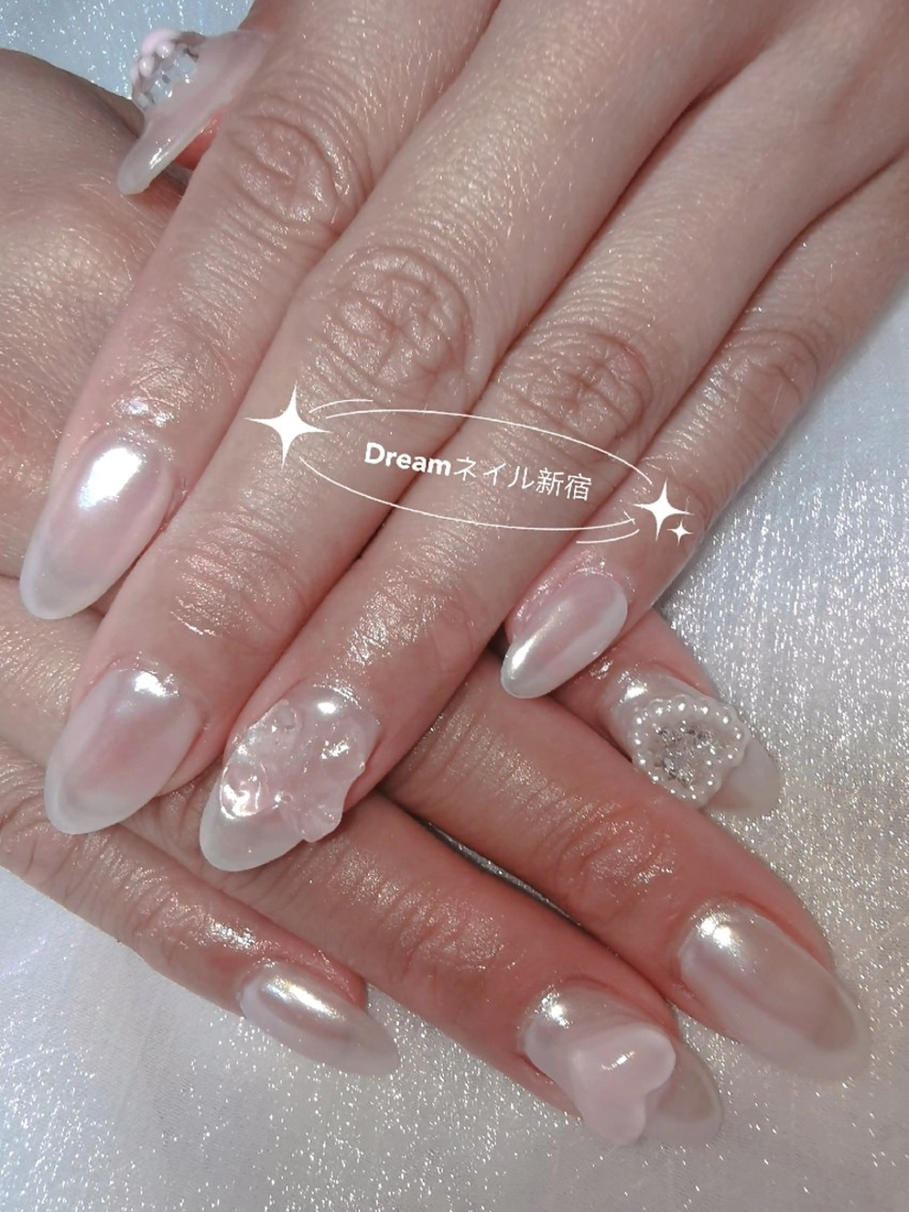 ネイル ハンドネイル ネイリストゆか💅 長さだし、深爪矯正のネイルデザイン