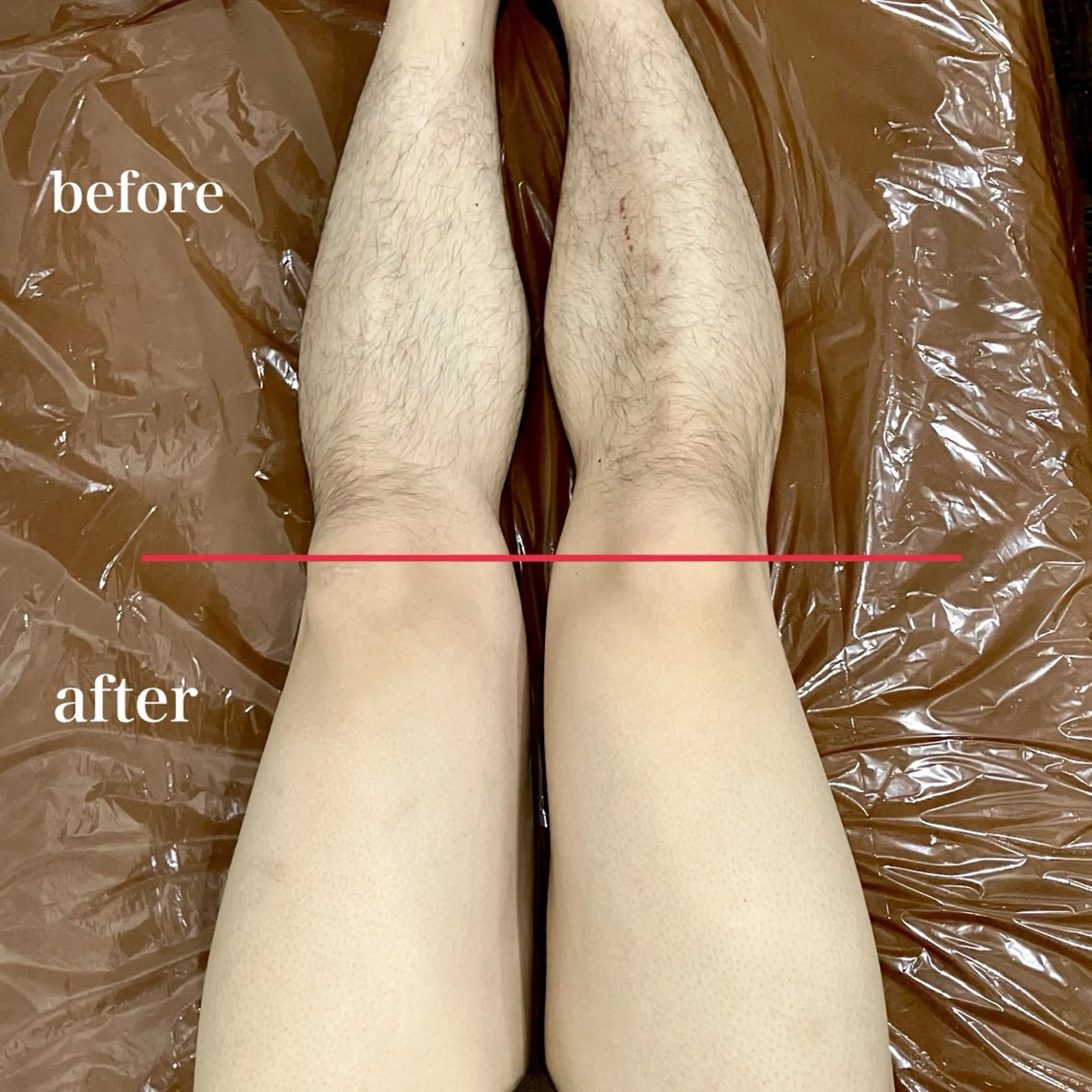 メンズ 脱毛 RICCO 堺東所属・RICCO 堺の眉毛・アイブロウイメージ