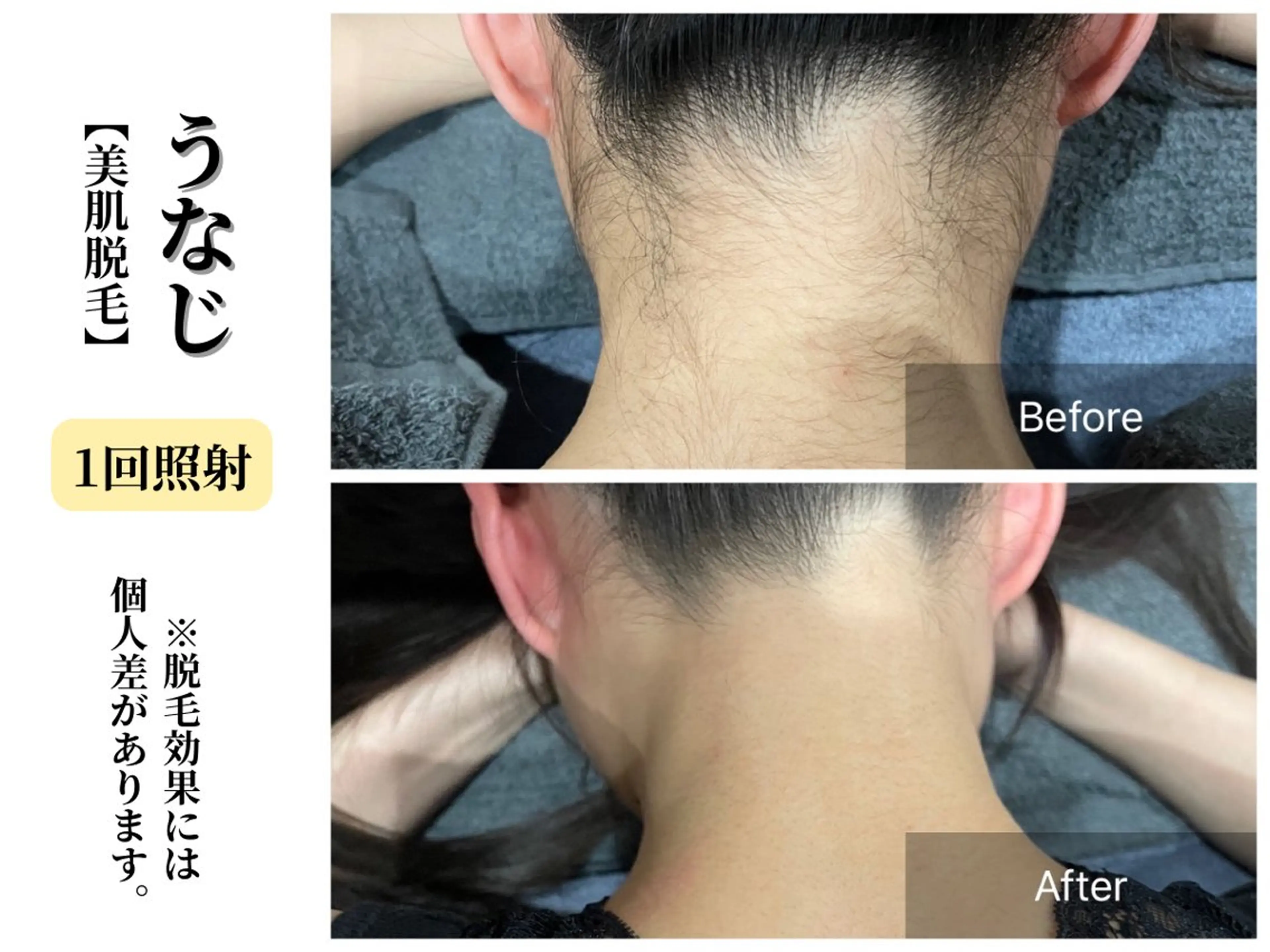 脱毛 Belle White所属・本格痩身＊肌質改善＊ BelleWhiteのエステ・リラクイメージ