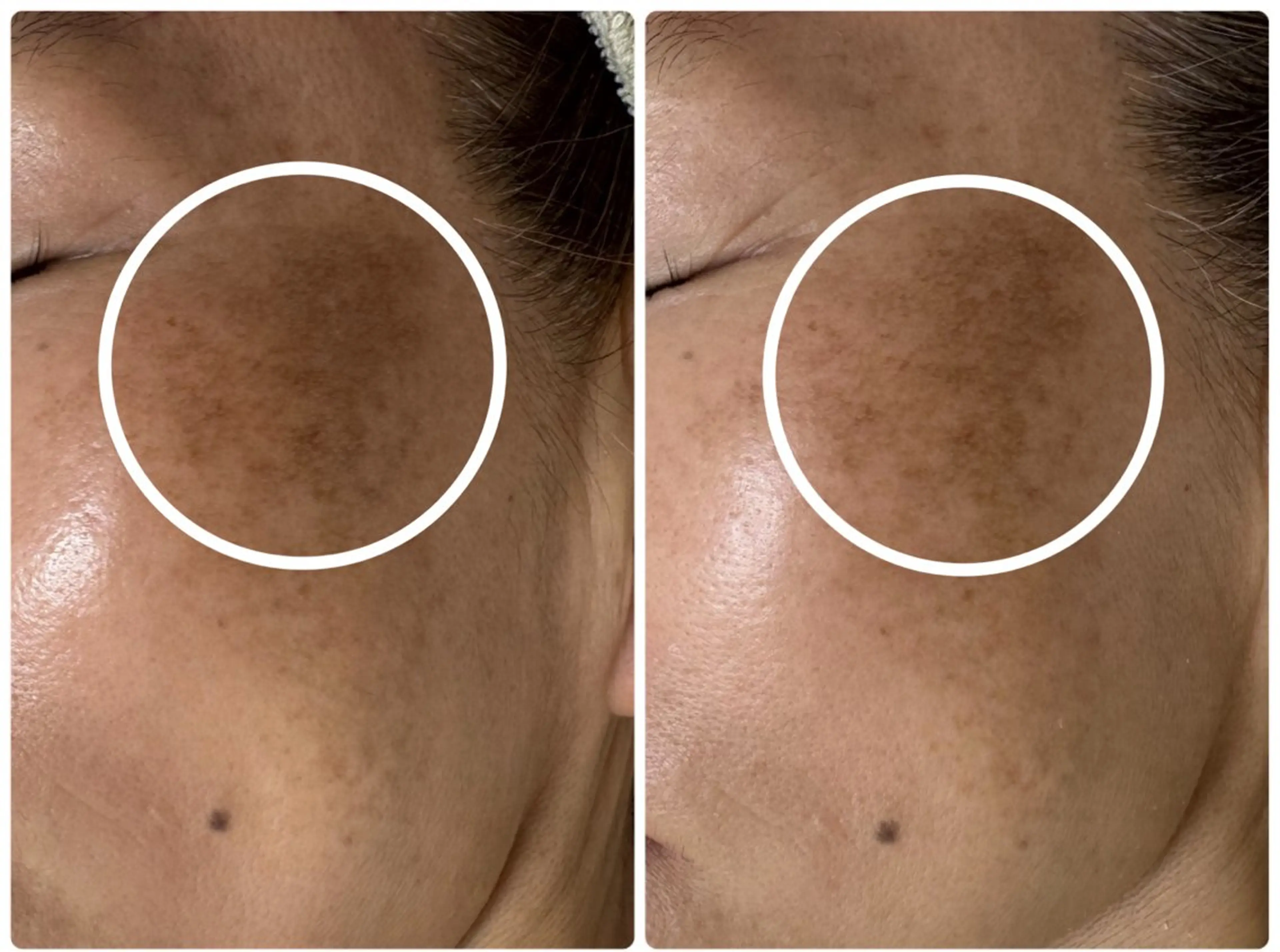 エステ リラク シミ毛穴専門店 yucca(ユッカ)のエステ・リラクイメージ