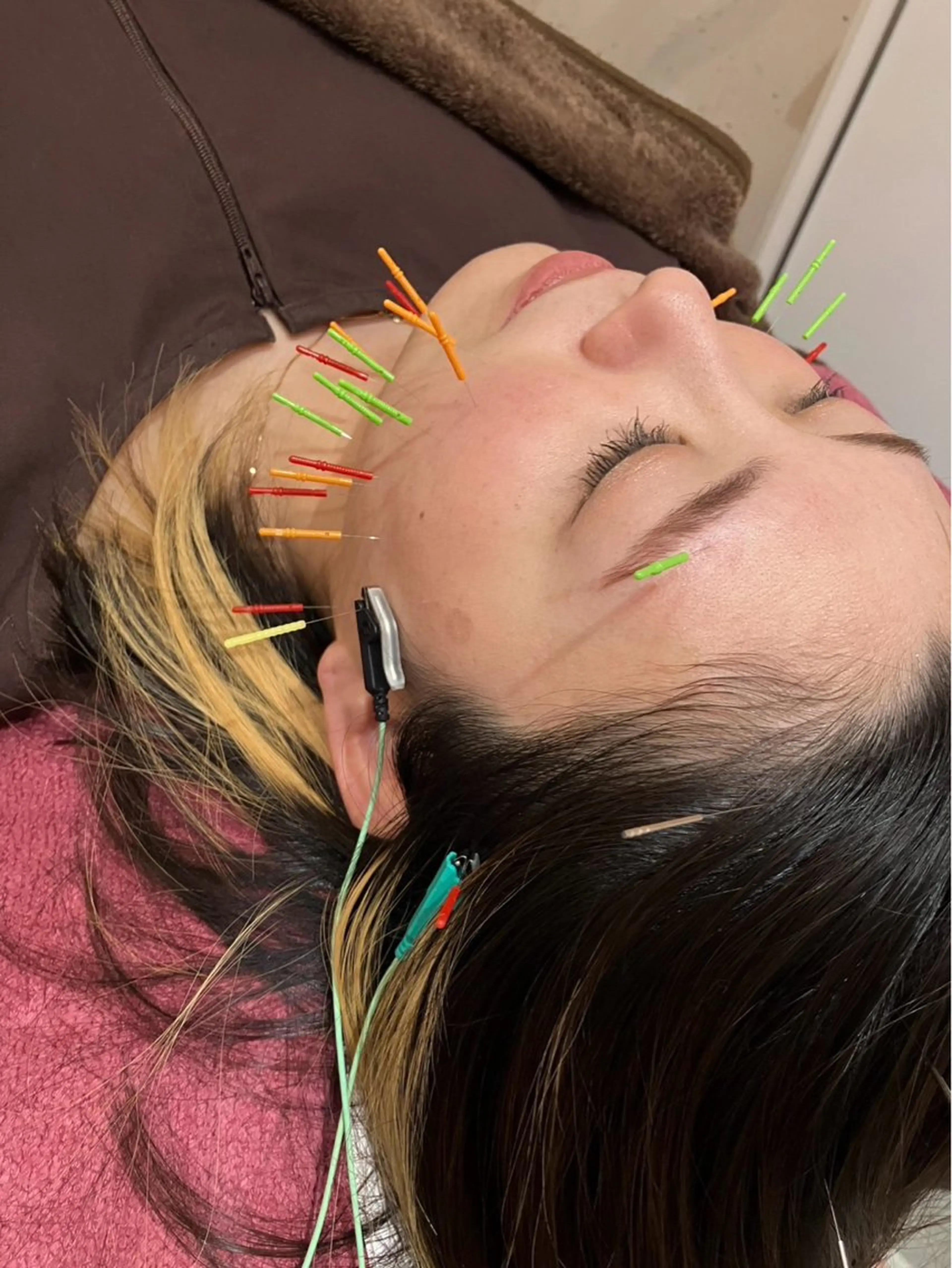 エステ リラク 美容鍼灸女性専用 りんご鍼灸治療院のその他イメージ