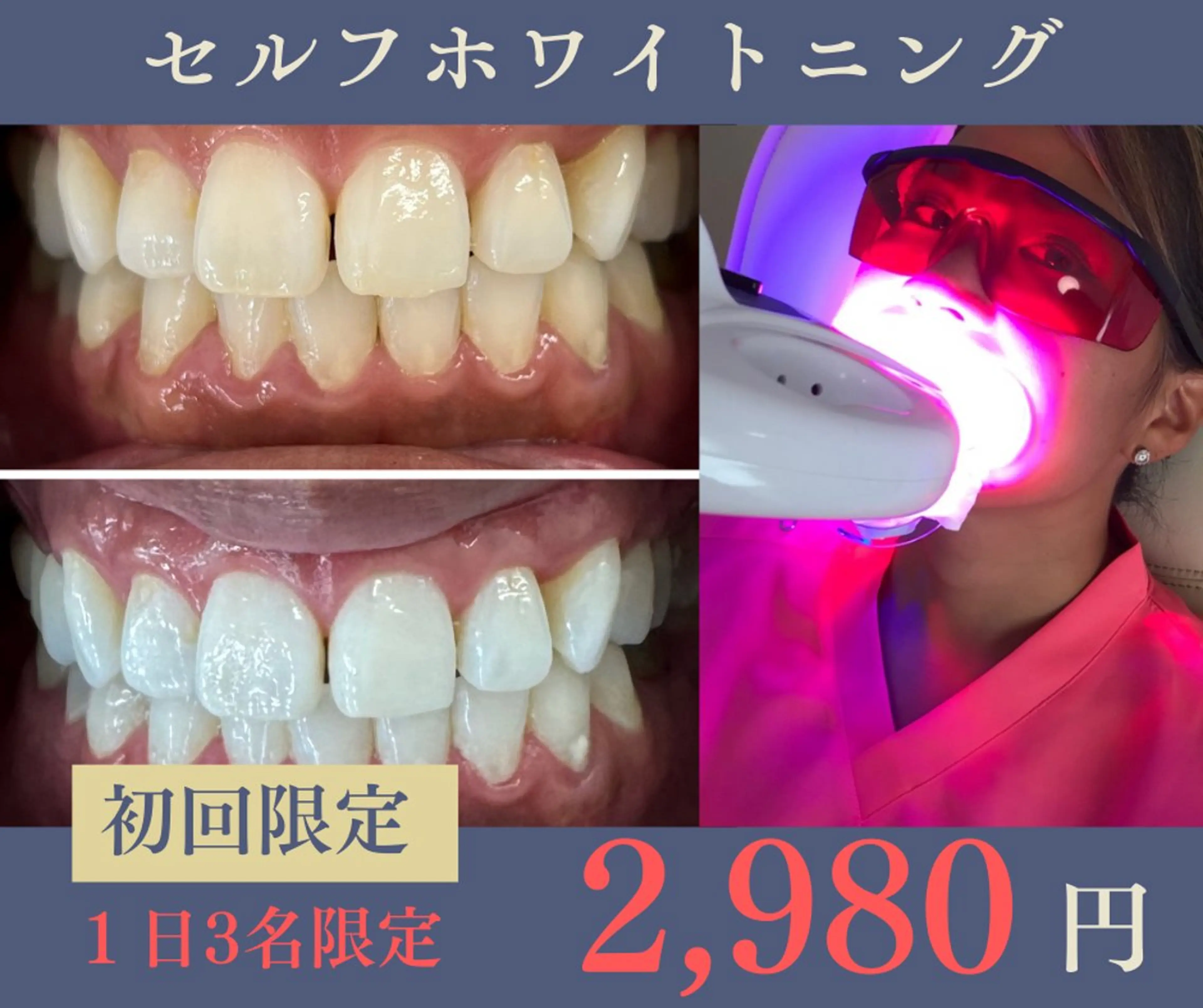 glitter.SHONAN所属・佐久間 茉弥のエステ・リラクイメージ