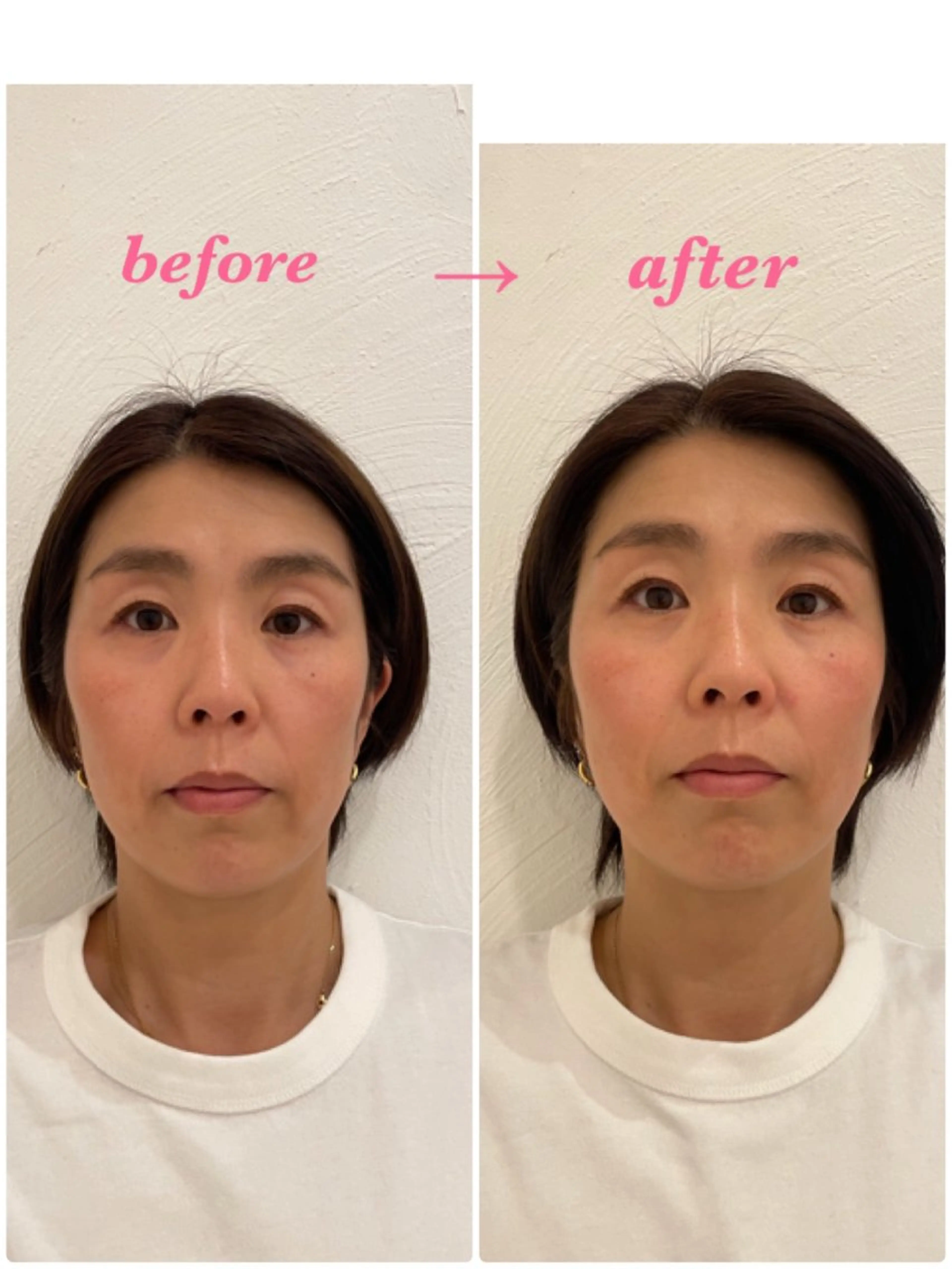 エステ リラク 美容鍼サロンメゾンブランシェ所属・🌸美容鍼サロン🌸 メゾンブランシェ🌈のエステ・リラクイメージ