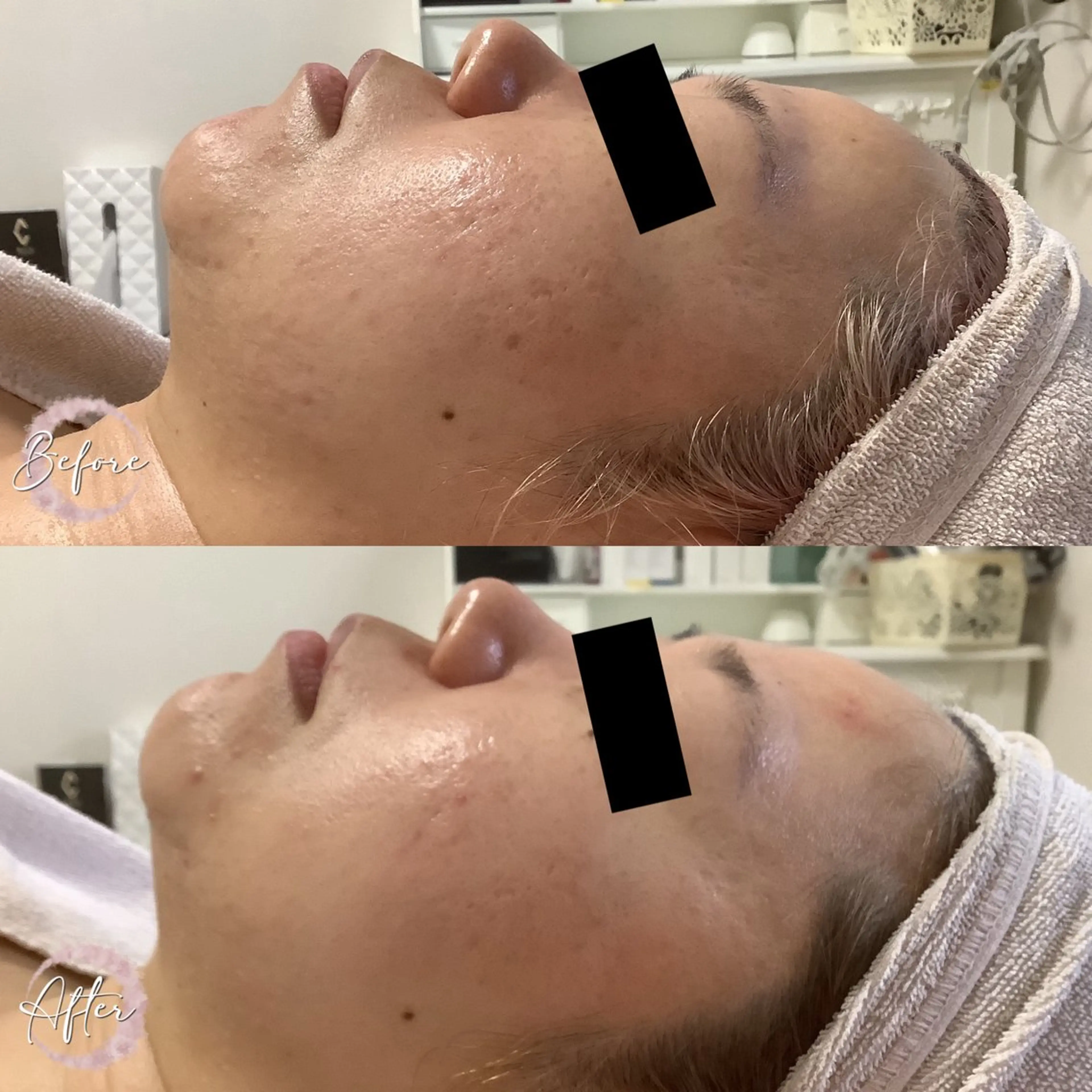 まつ毛パーマ・美肌 ナチュラル　ボーテのマツエク・マツパデザイン