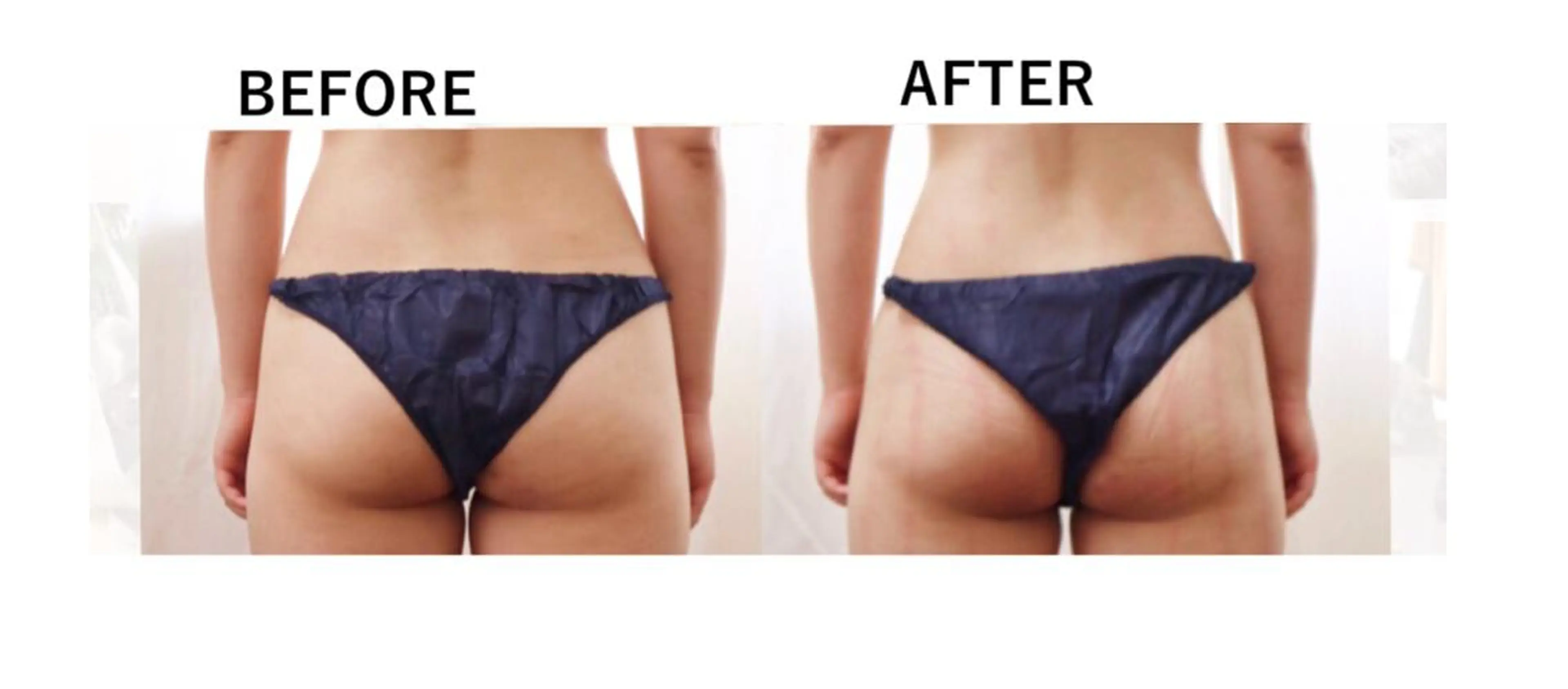 RENsalon大阪 体質改善リトリートのエステ・リラクイメージ