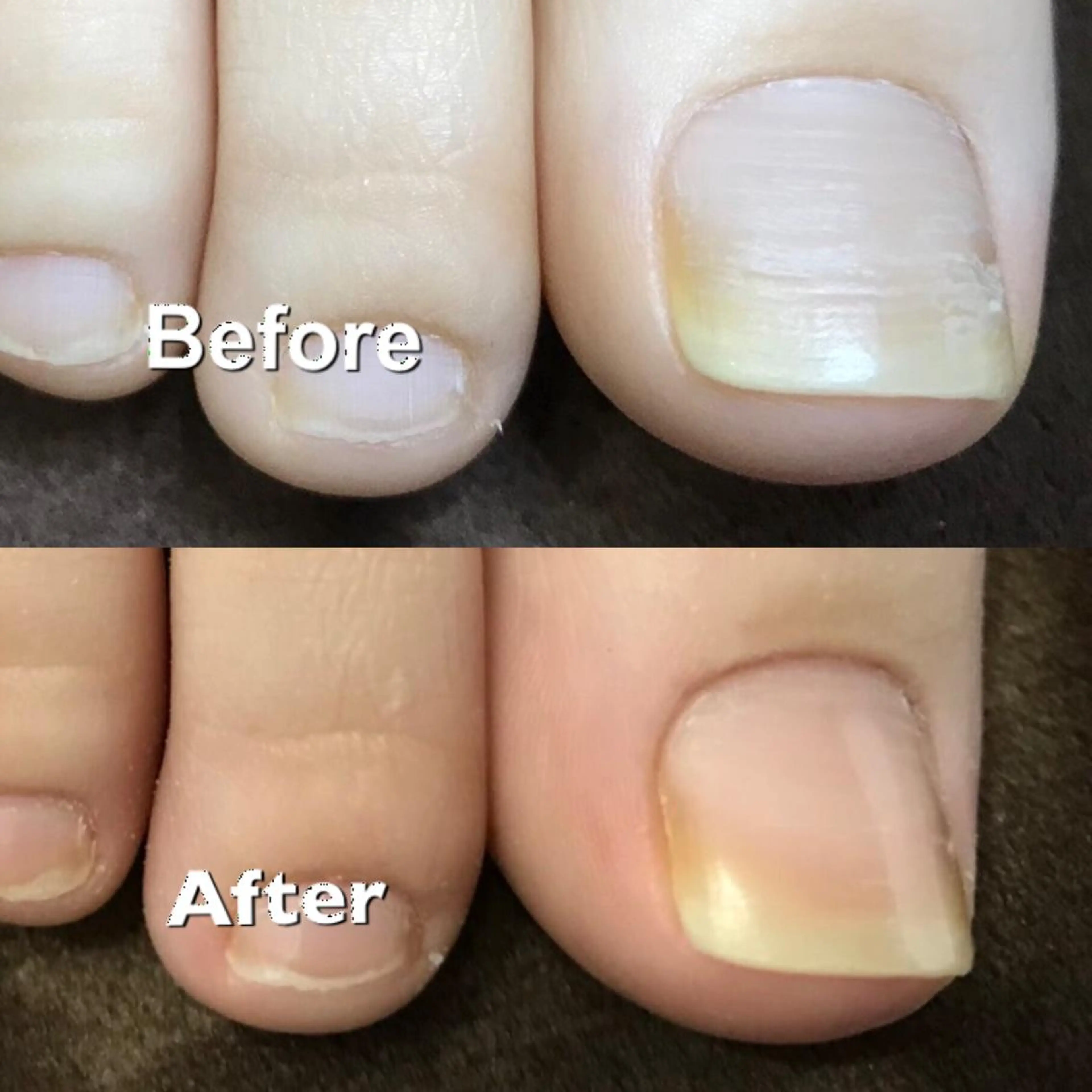 かかとツルツル☆ドイツ式フットケア60分の写真