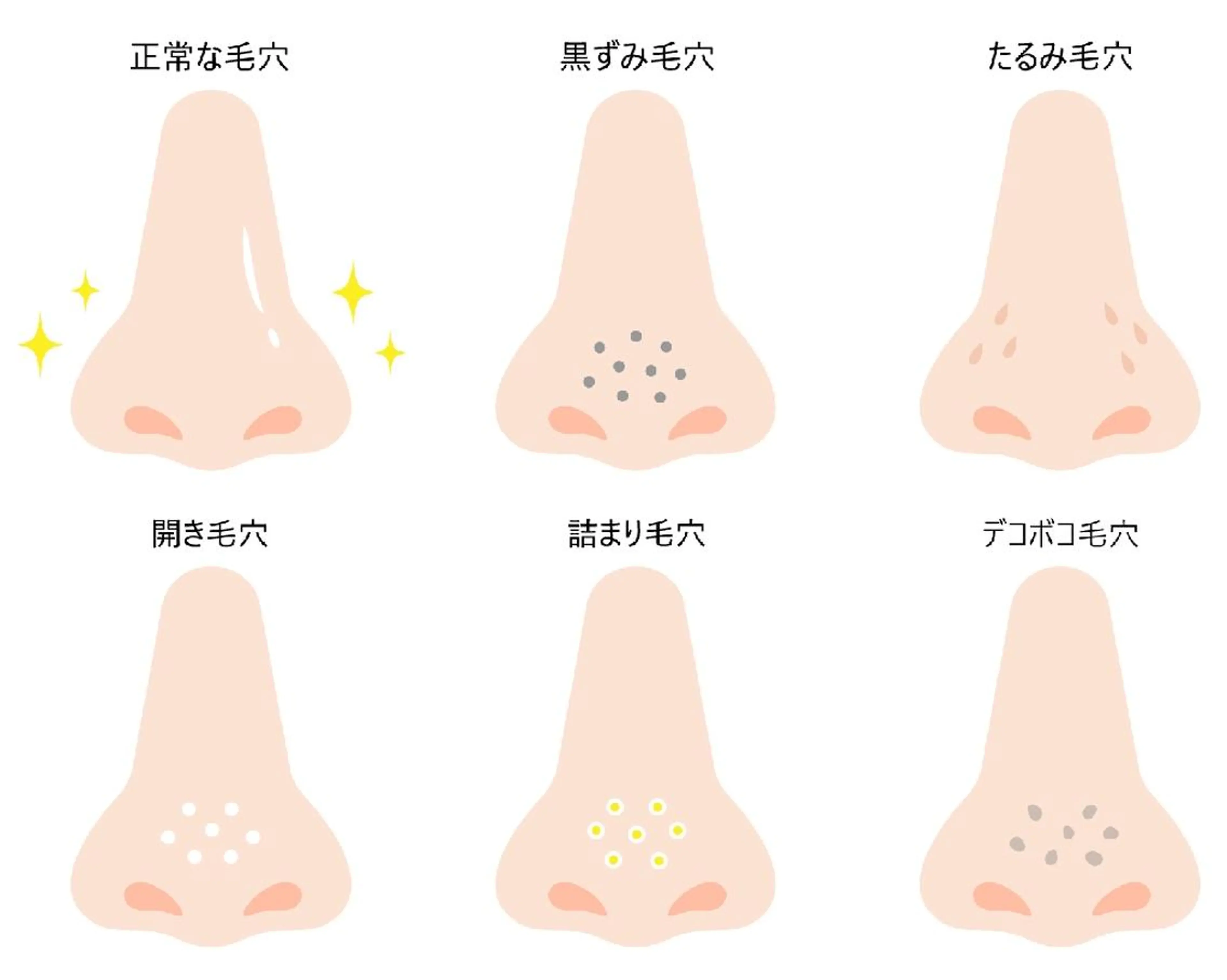 毛穴ケア体験の写真