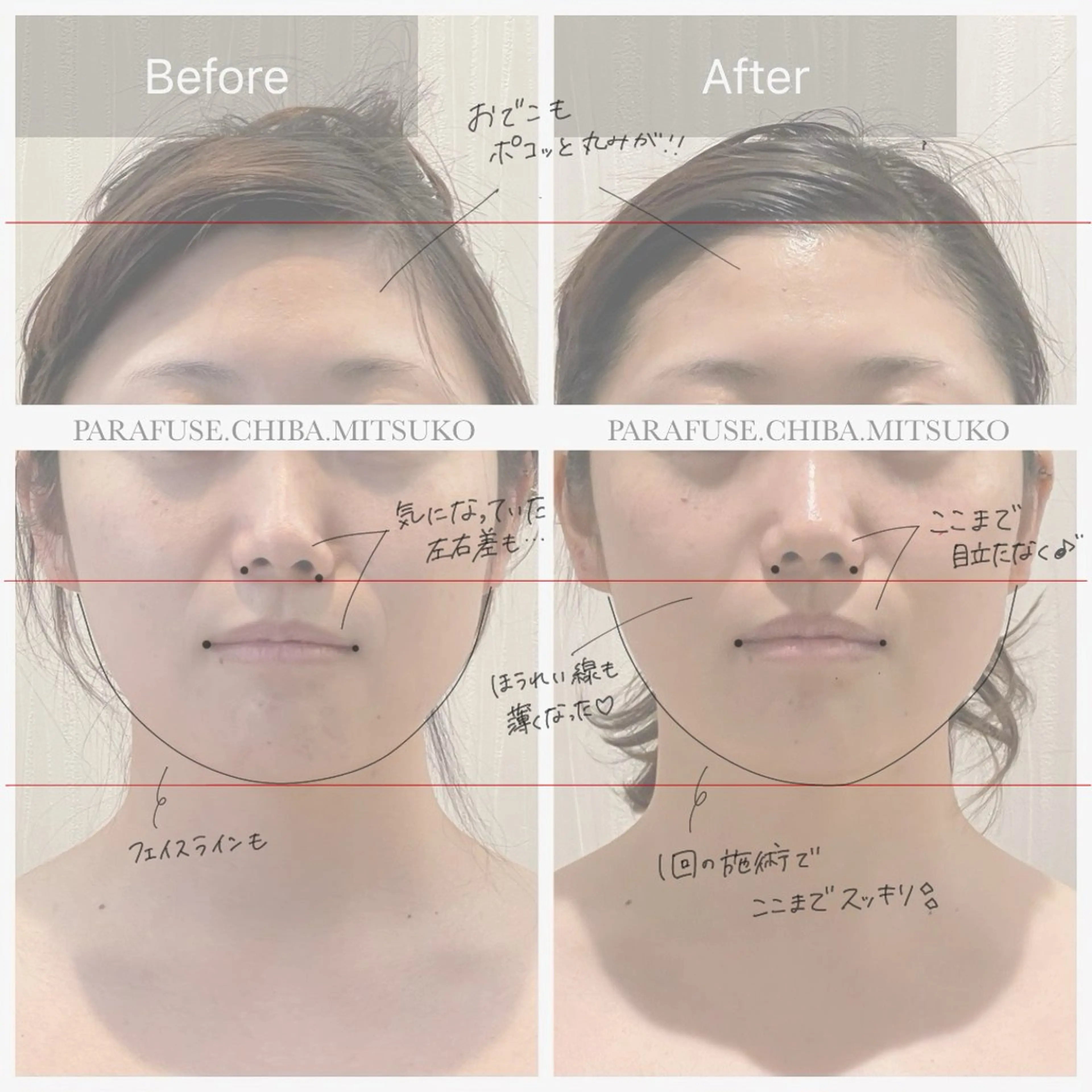 Nature所属・脳洗浄✳︎マツヤニ/ みつこのエステ・リラクイメージ