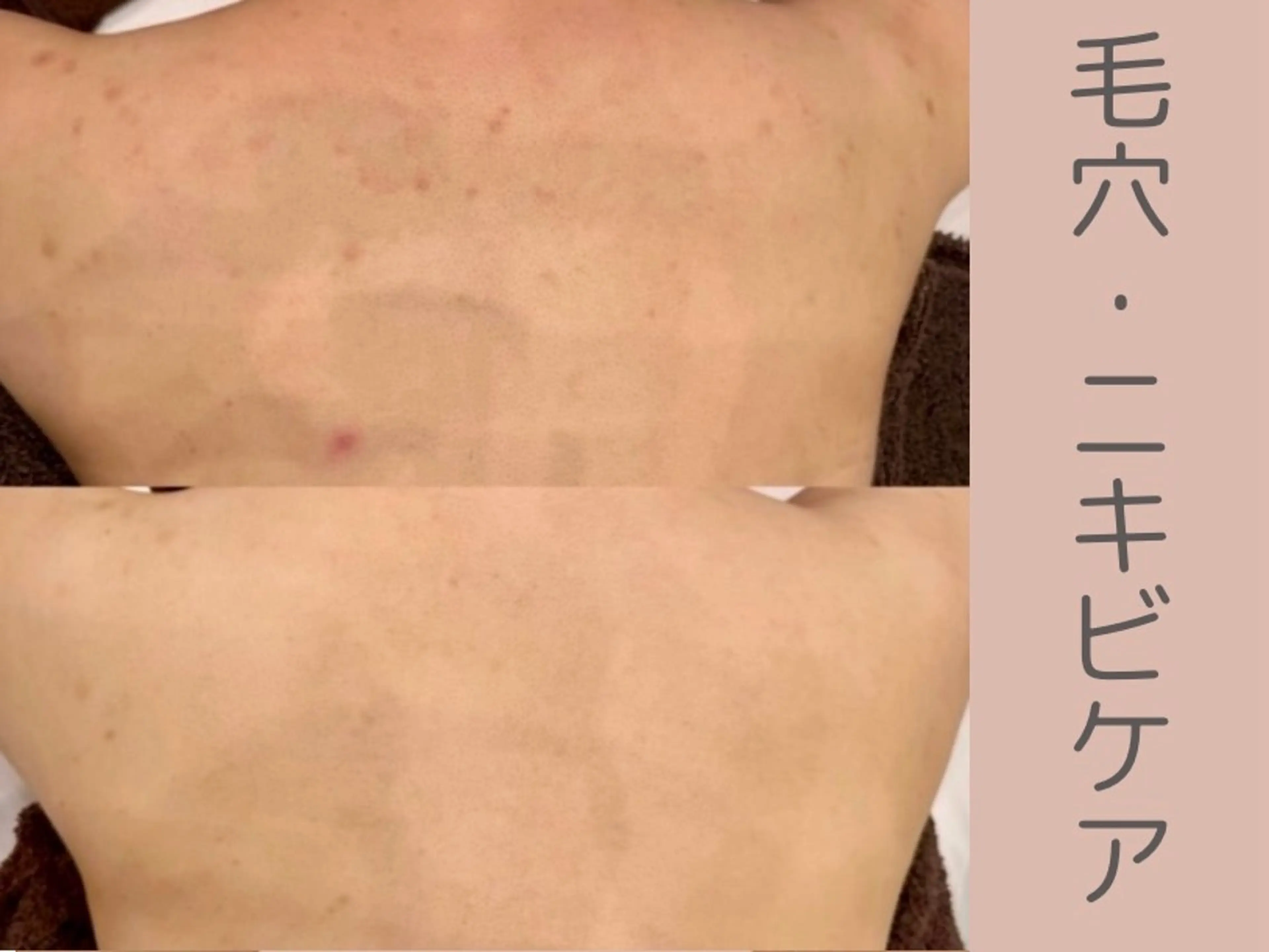 べアール所属・小顔/毛穴/ニキビ salon bealのその他イメージ