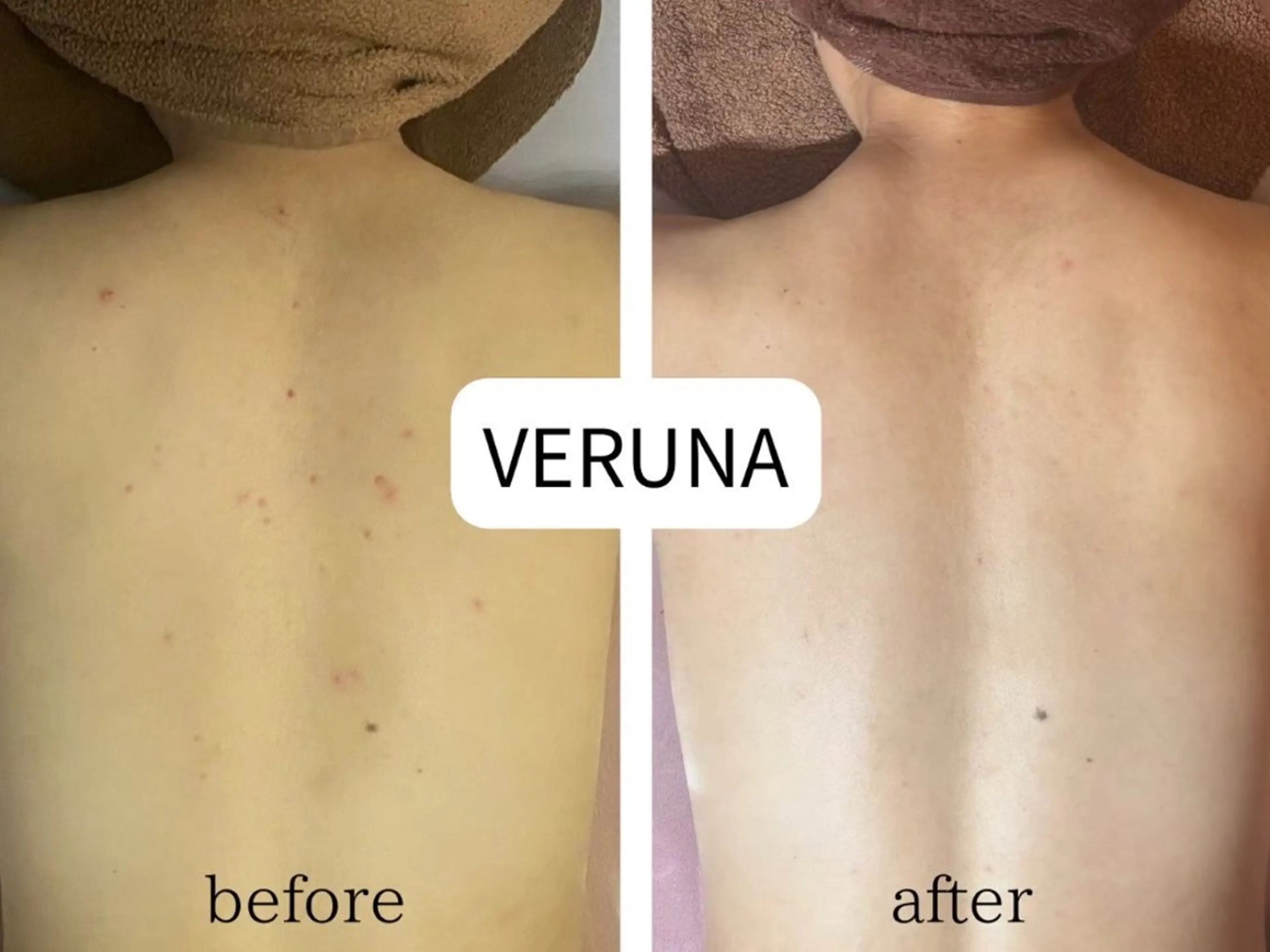 毛穴&ニキビ専門　Bonita Ange恵比寿所属・毛穴ニキビ専門 BonitaAngeのエステ・リラクイメージ