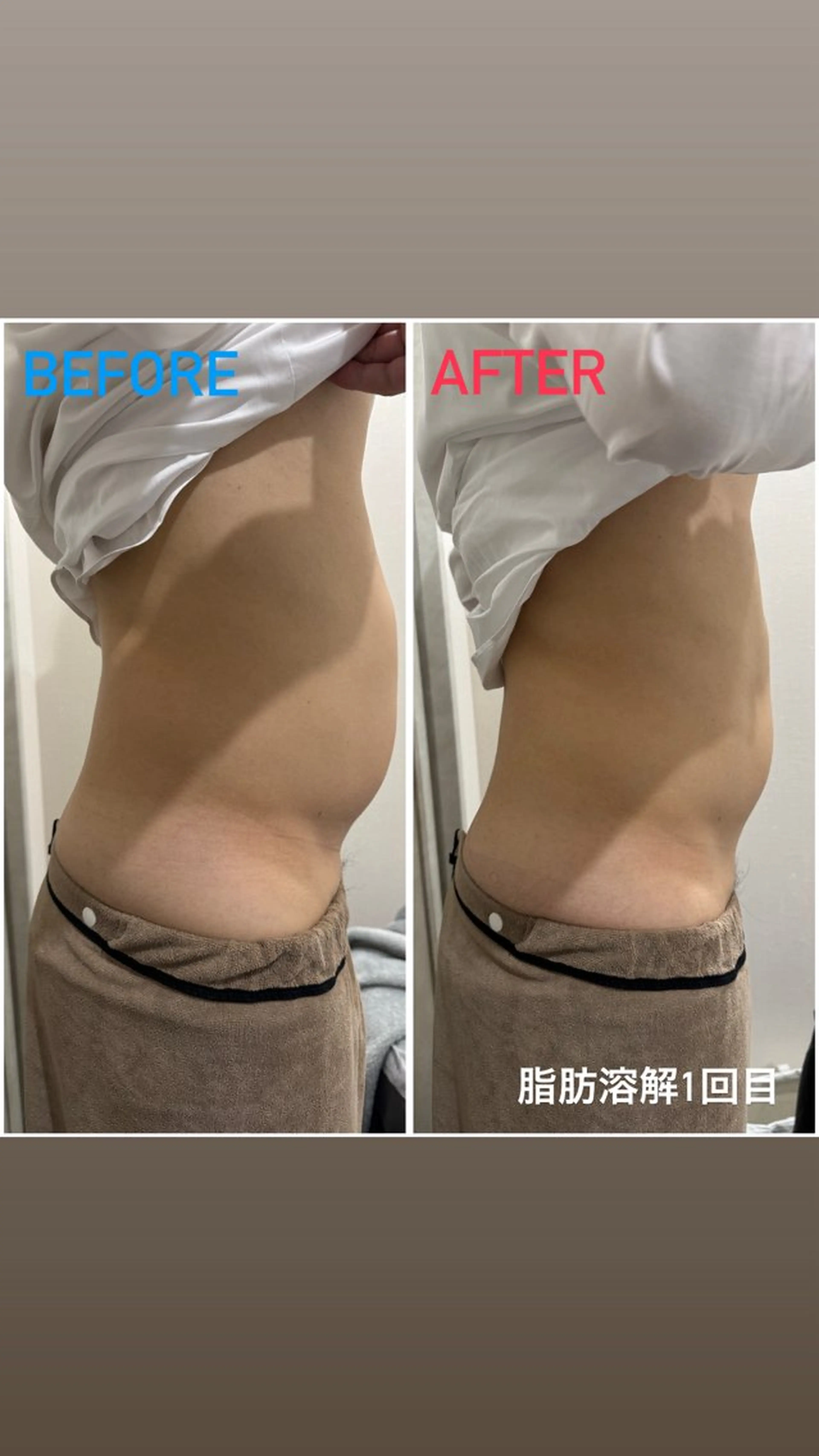 エステ アルカンジュ~archange~所属・痩身/毛穴洗浄/脱毛 アルカンジュのエステ・リラクイメージ