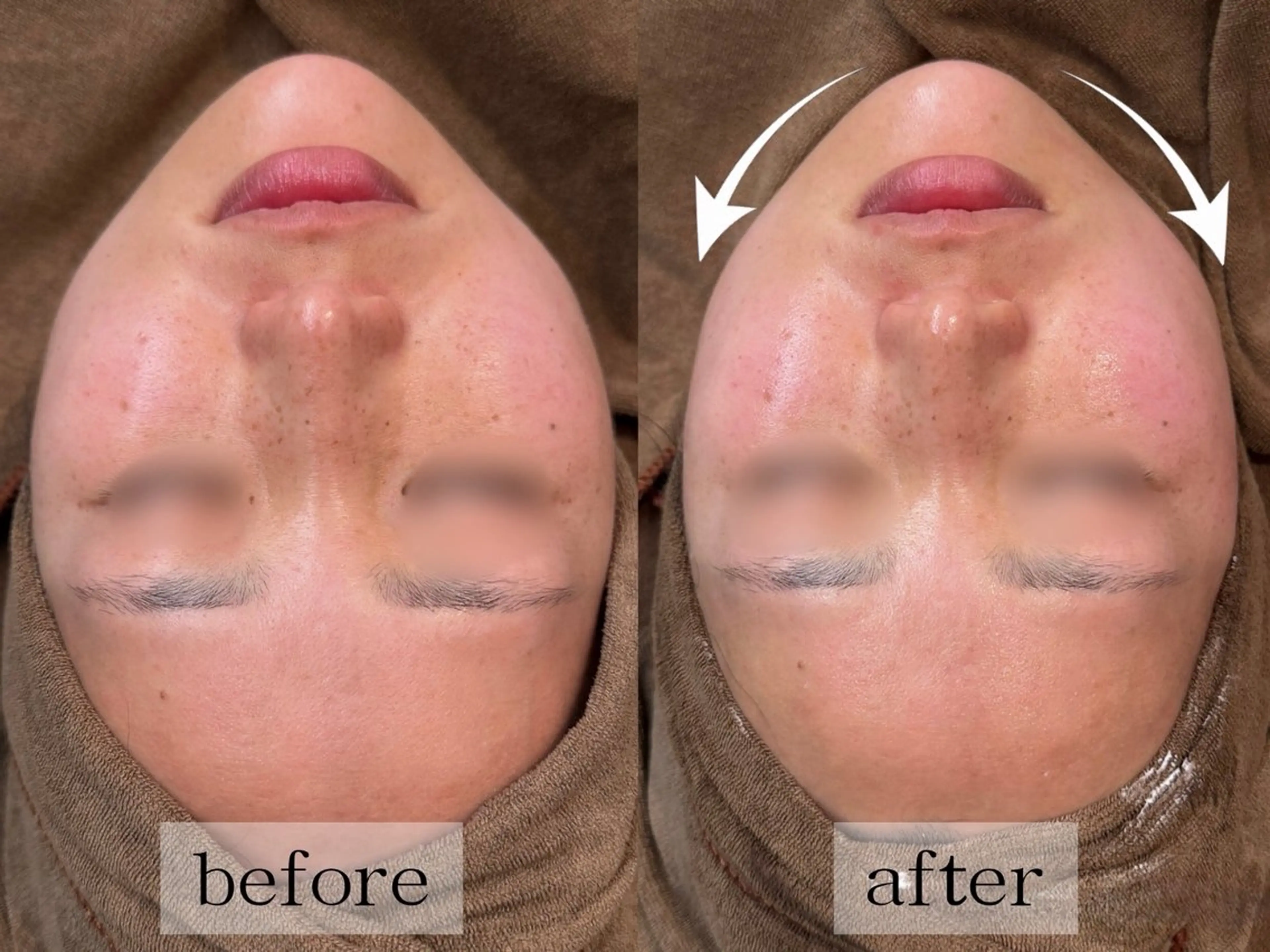 毛穴・肌質ケア専門 グランビューティーのエステ・リラクイメージ