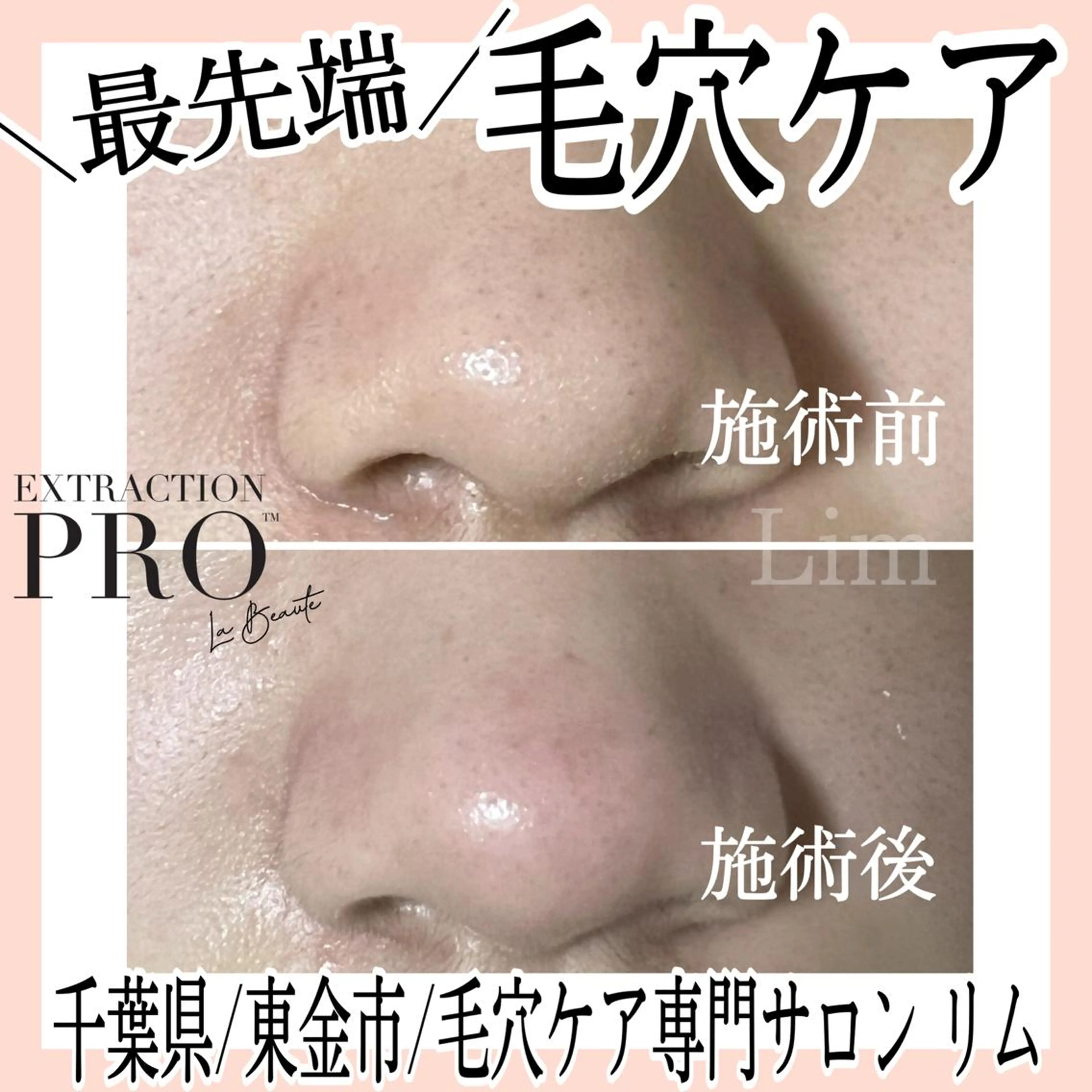 Lim Naomiのマツエク・マツパデザイン