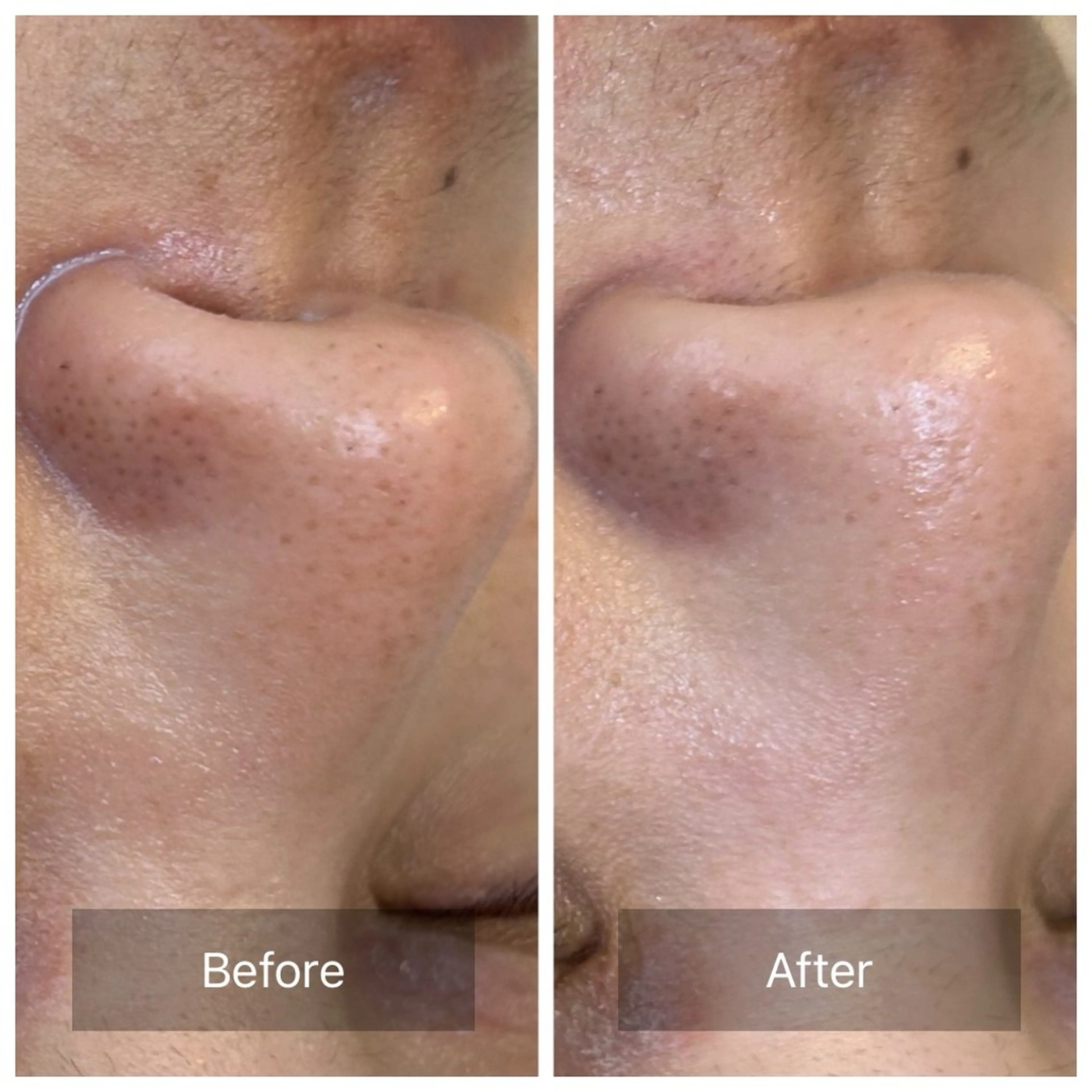 エステ リラク facial aesthetic salon SENTEUR所属・美肌改善/毛穴/シミ サントゥールのエステ・リラクイメージ