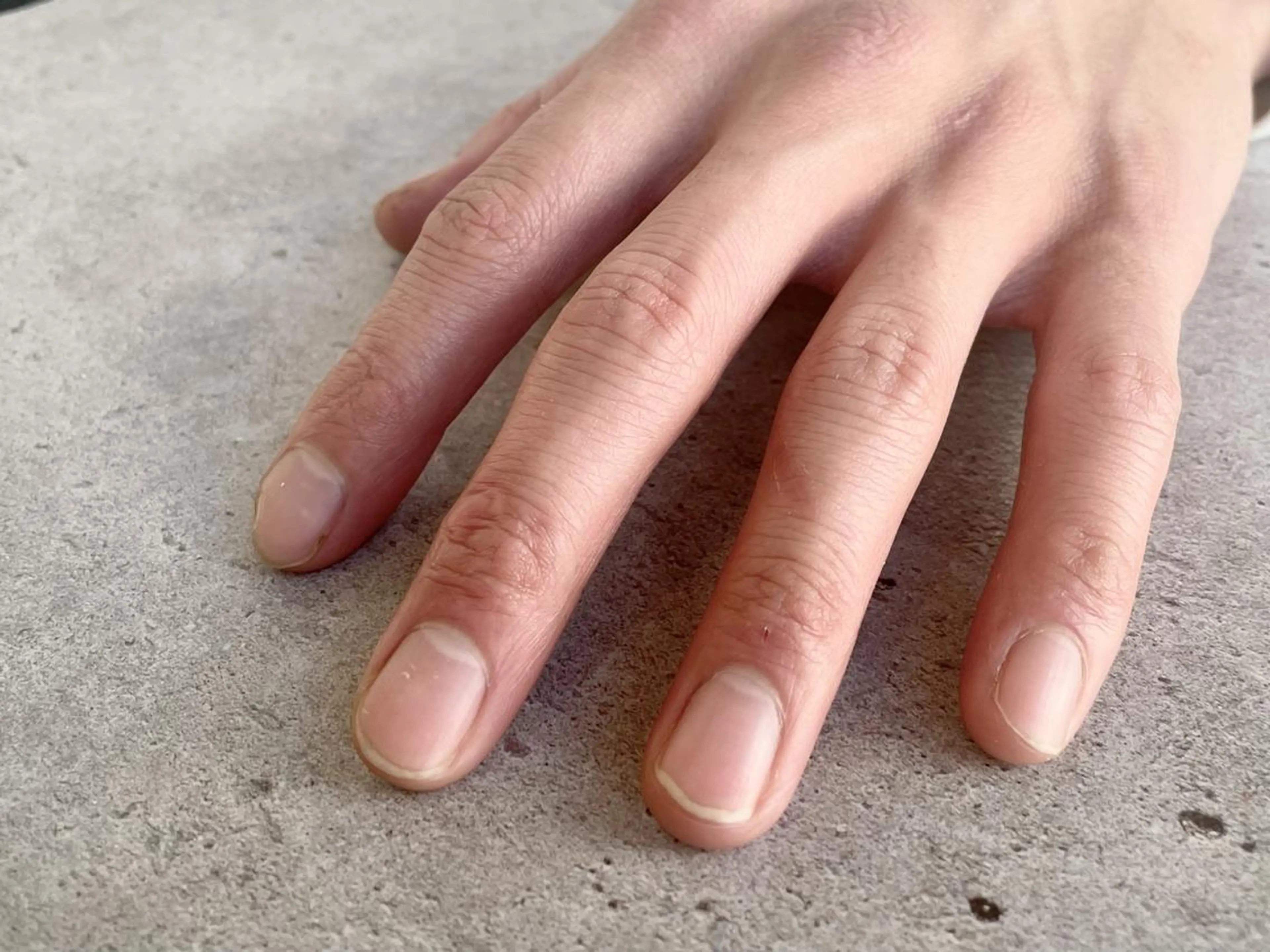 ネイルオフのみの写真