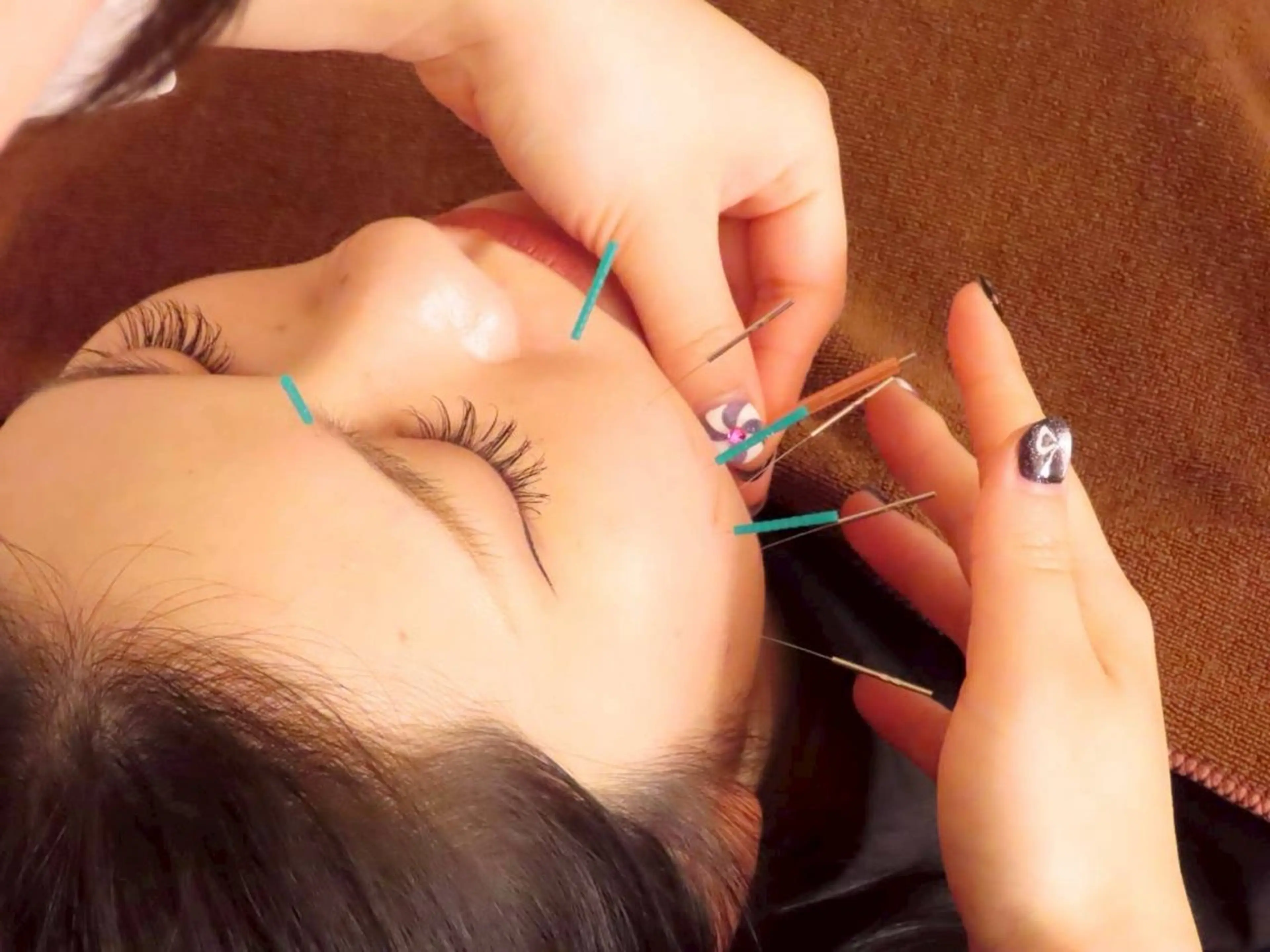 99-KUKU-所属・天神美容鍼99 -KUKU-吉弘萌香のエステ・リラクイメージ