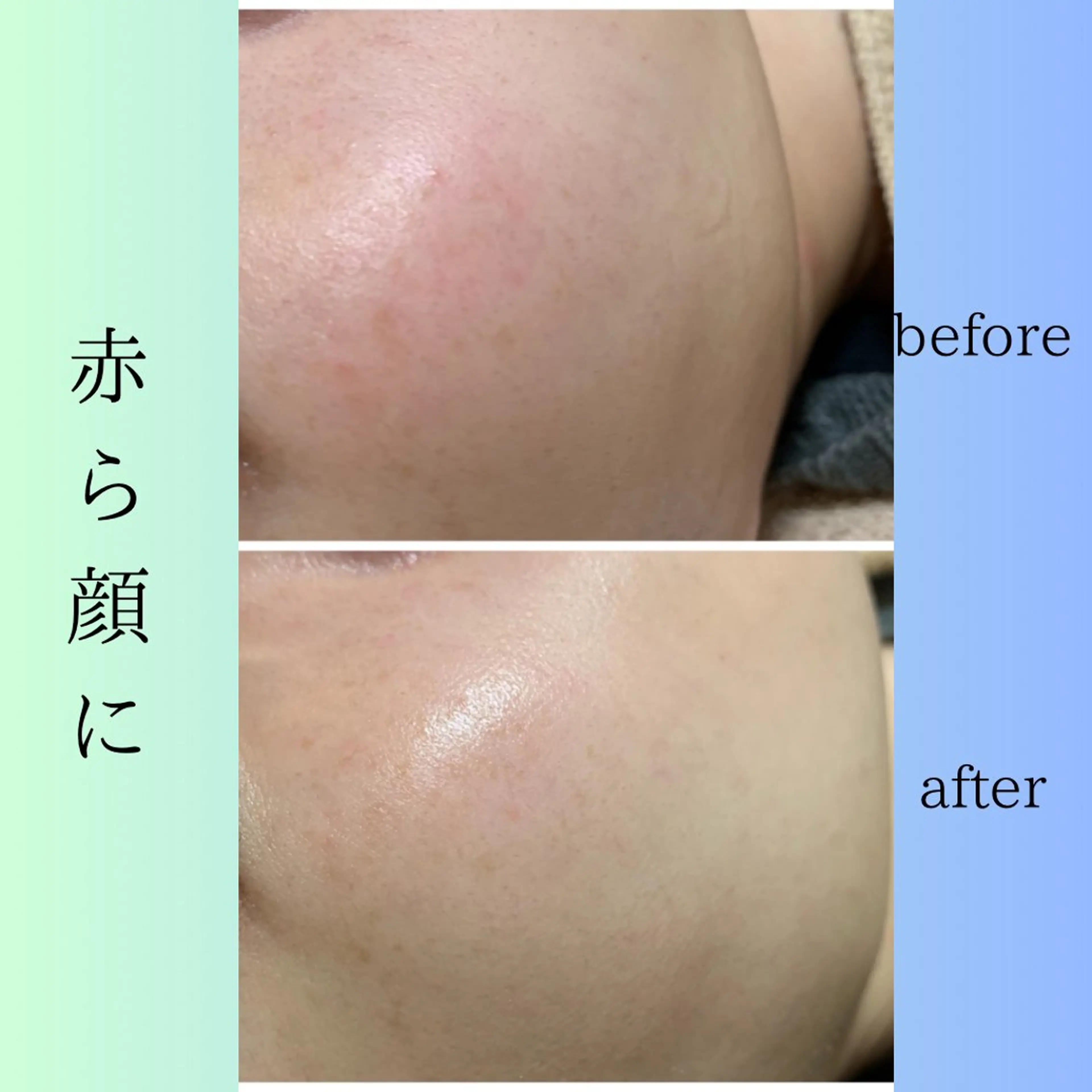 プライベートサロンCuara所属・プライベートサロン Cuaraのエステ・リラクイメージ