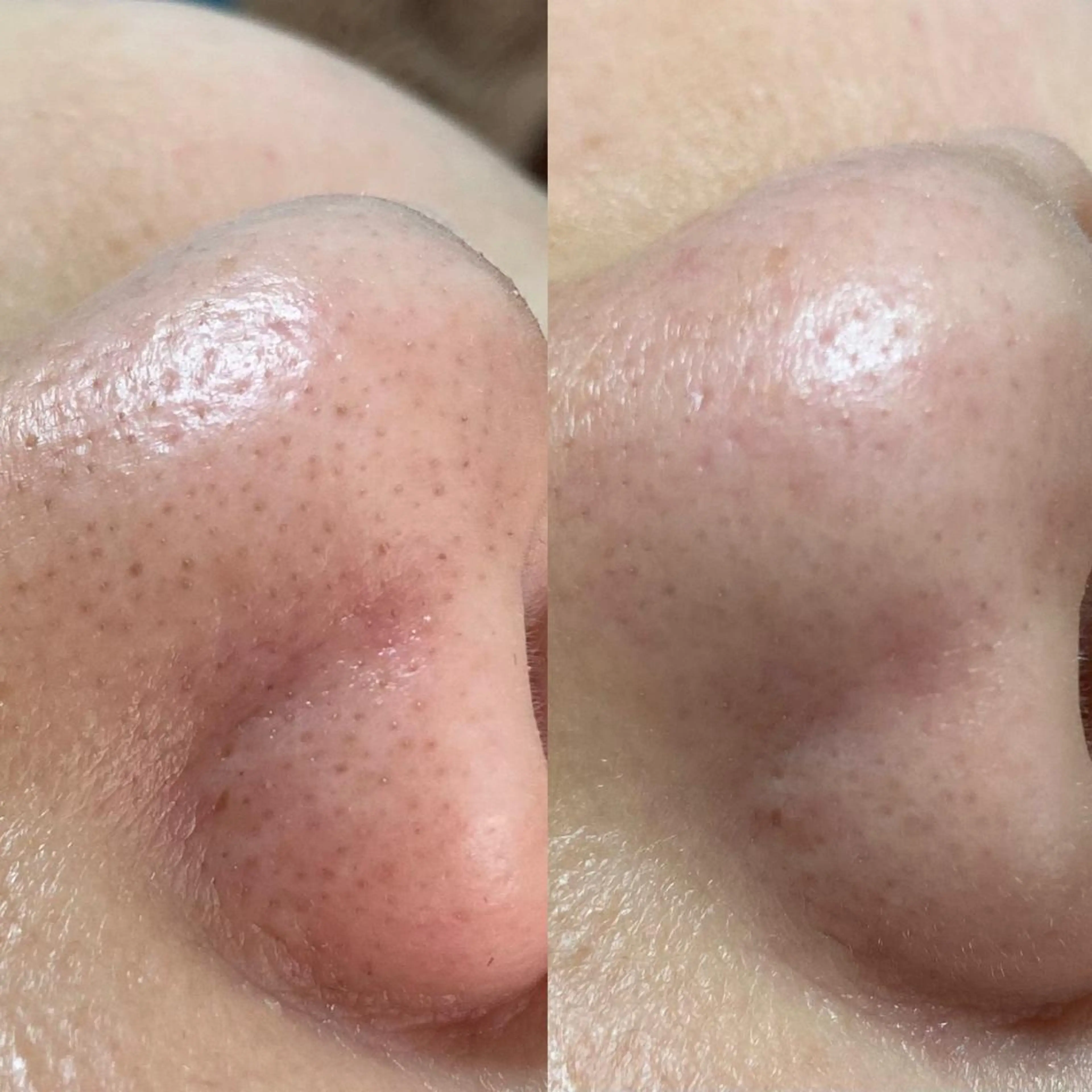 eyelashsalon Plaisir所属・ツカハラ ミカのエステ・リラクイメージ