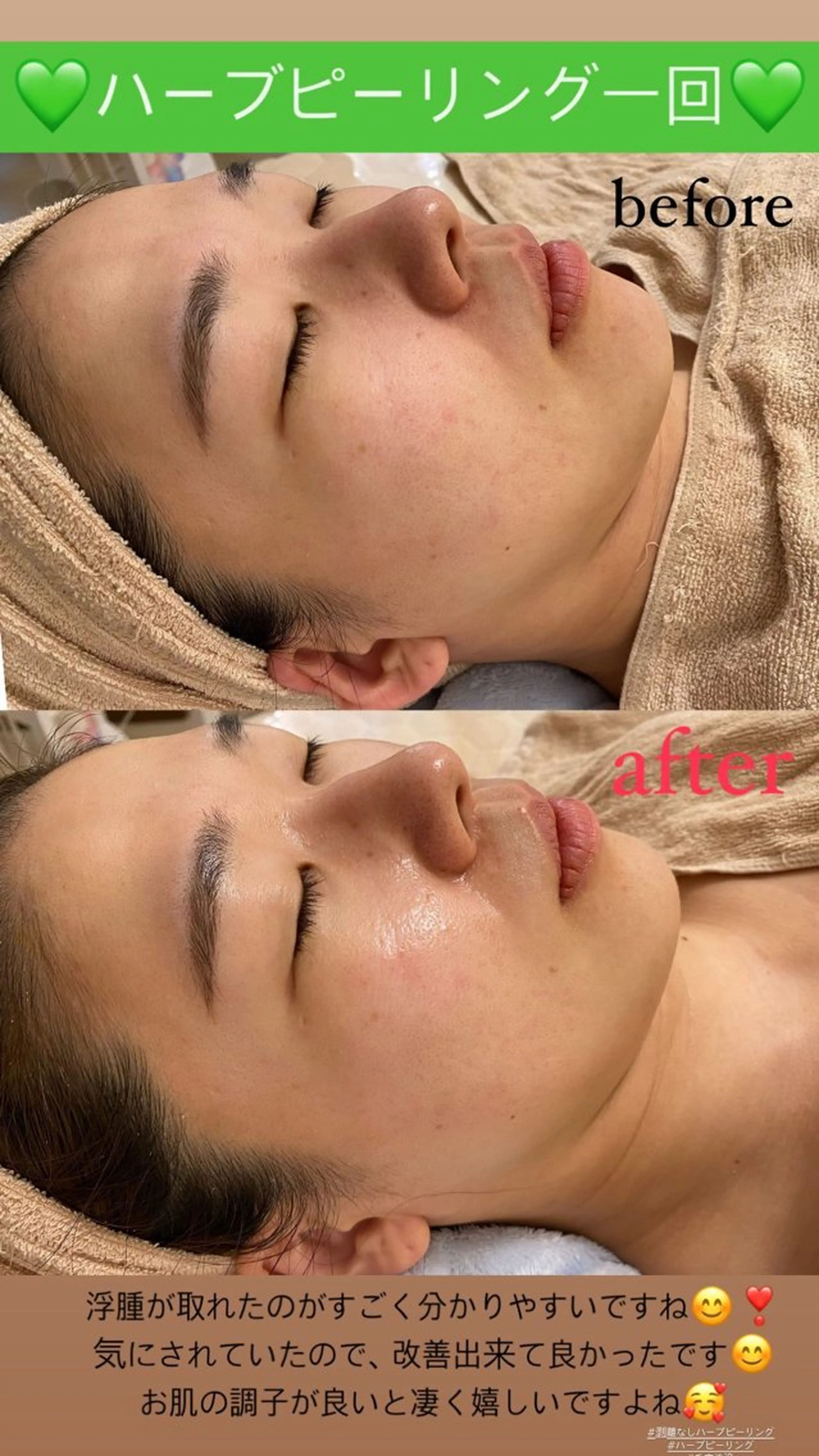 エステ Salon de Lino 御器所のエステ・リラクイメージ