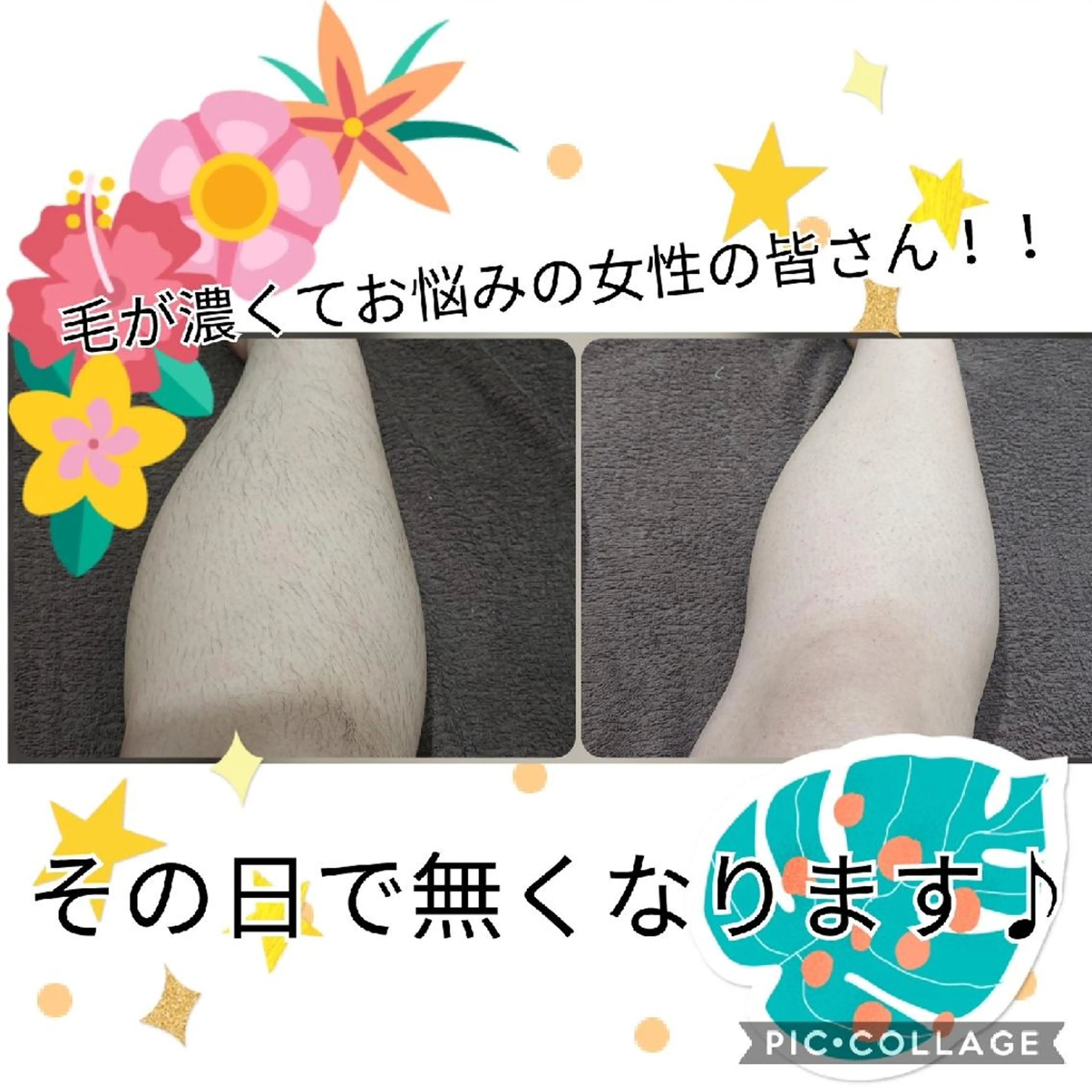 脱毛 リラクゼーション ふわりのエステ・リラクイメージ