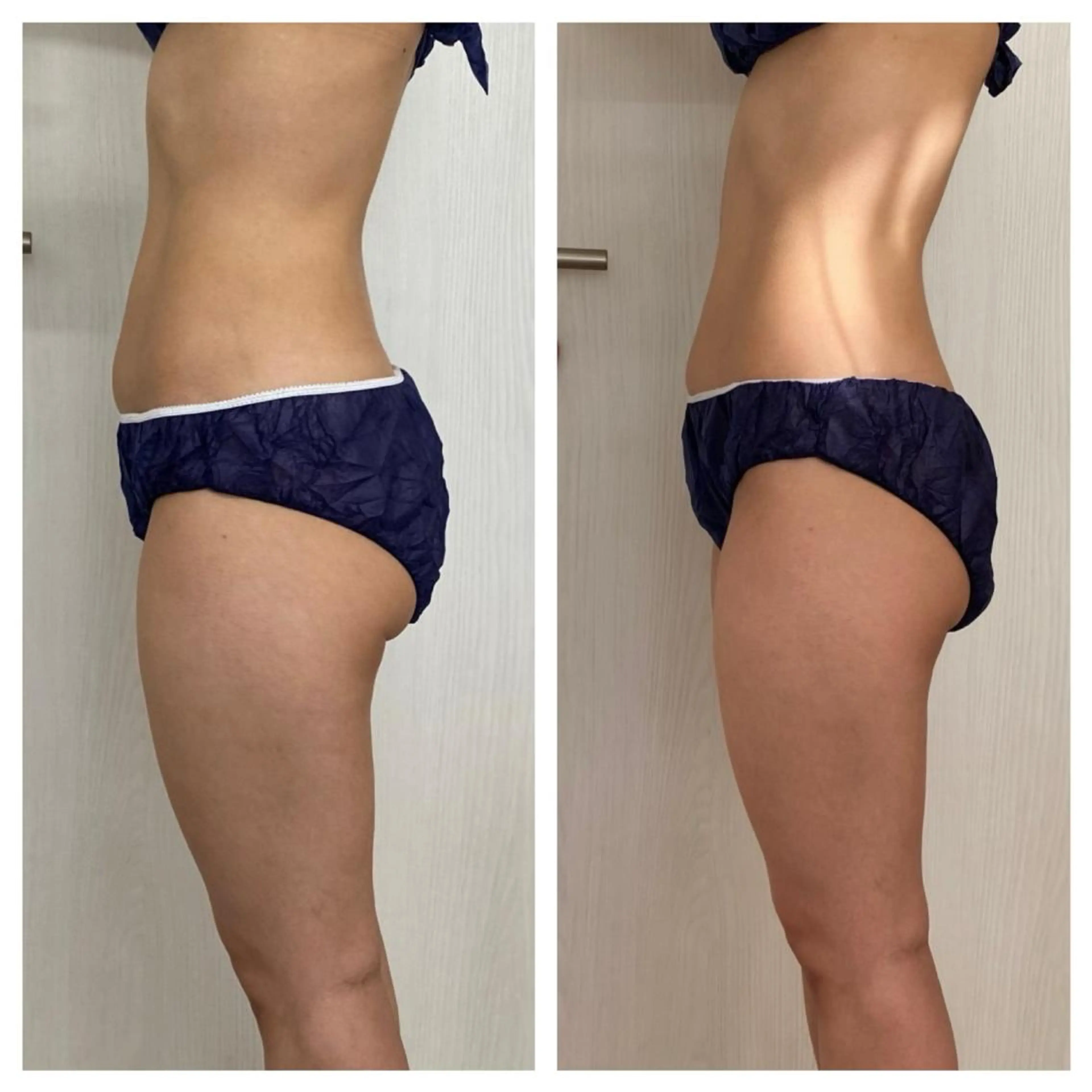 エステ 武藤 千裕のエステ・リラクイメージ