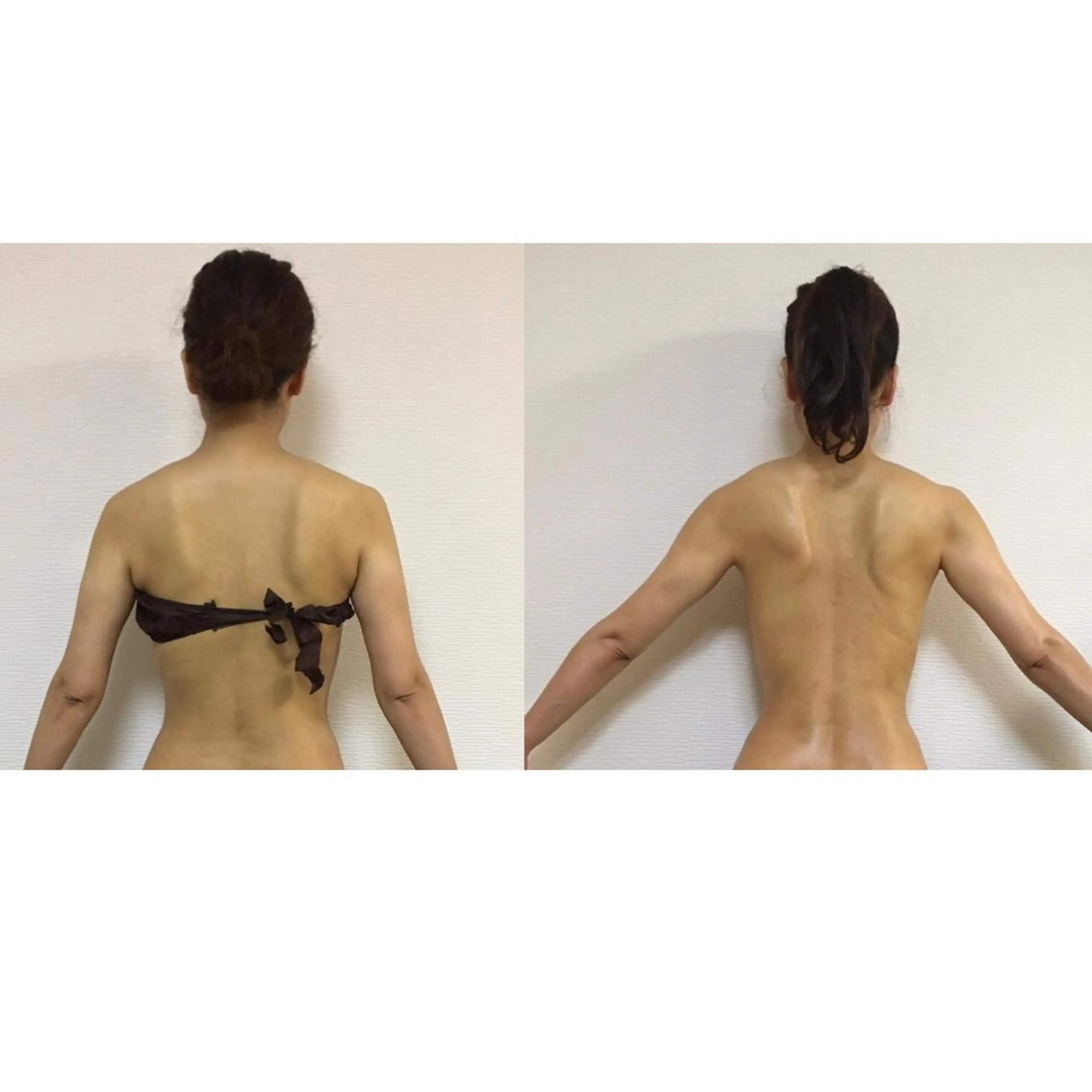 120分全身フル筋膜矯正👠✨の写真