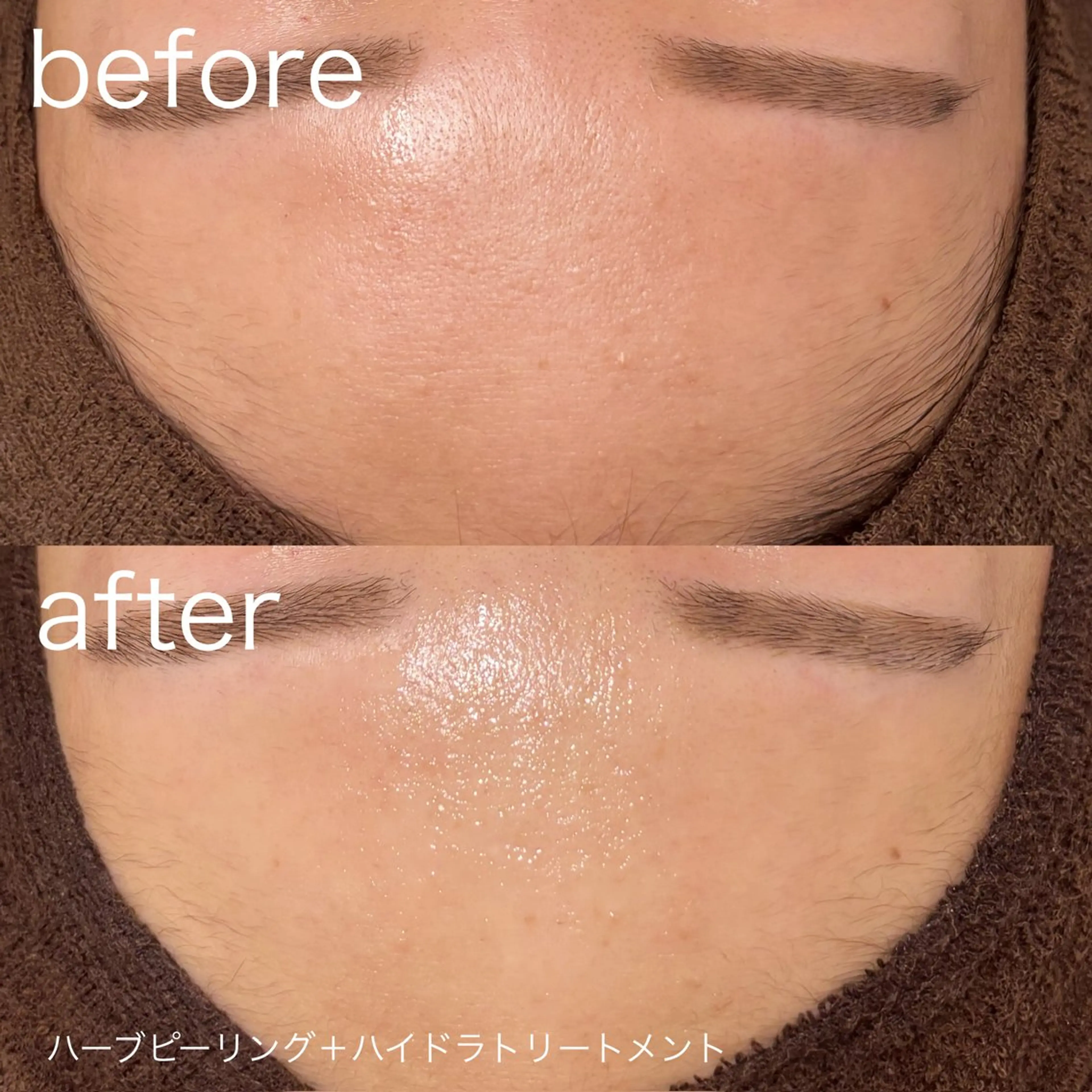 脱毛 lulula ricoのエステ・リラクイメージ