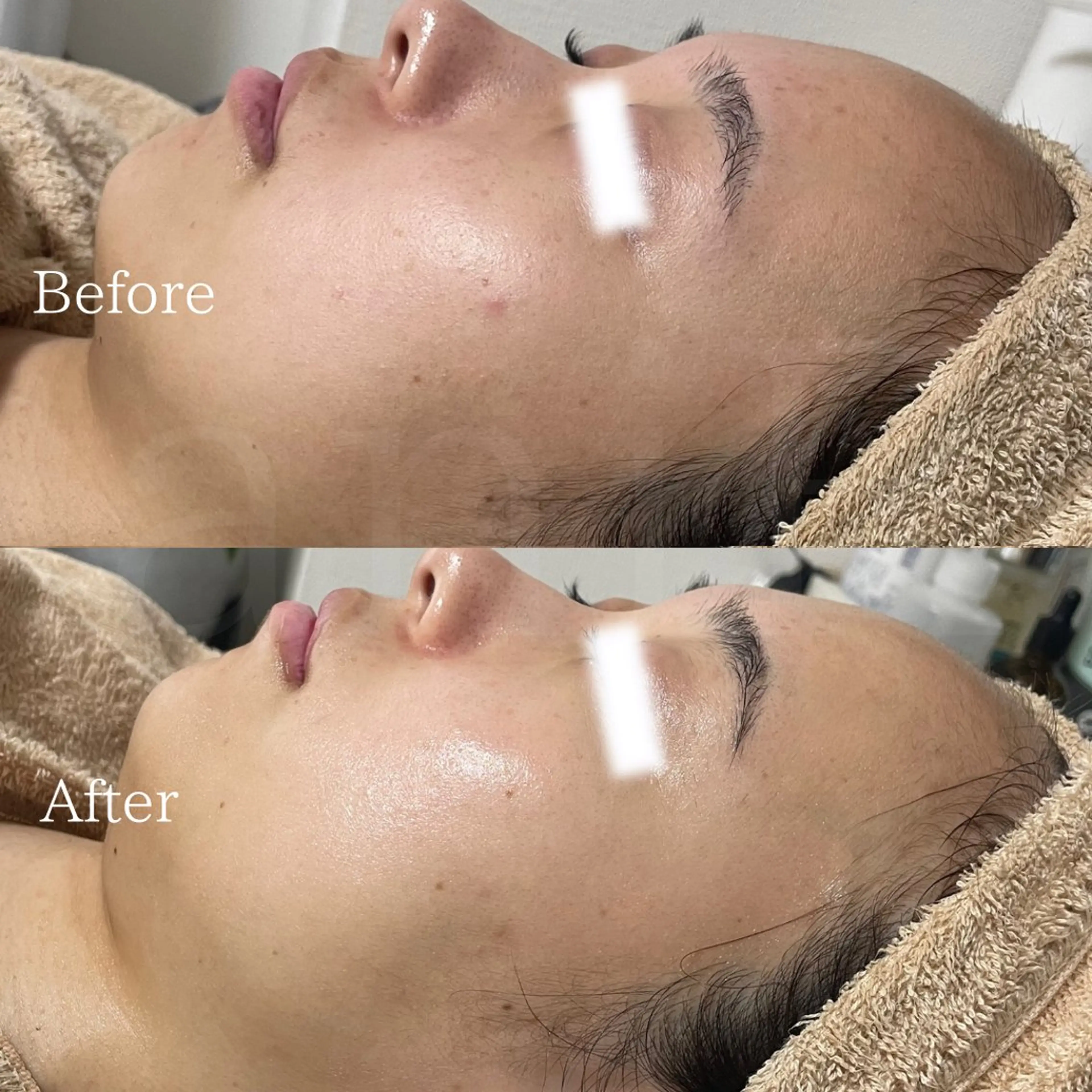 エステ 北浜/毛穴洗浄ツヤ肌 サロンaniRのエステ・リラクイメージ