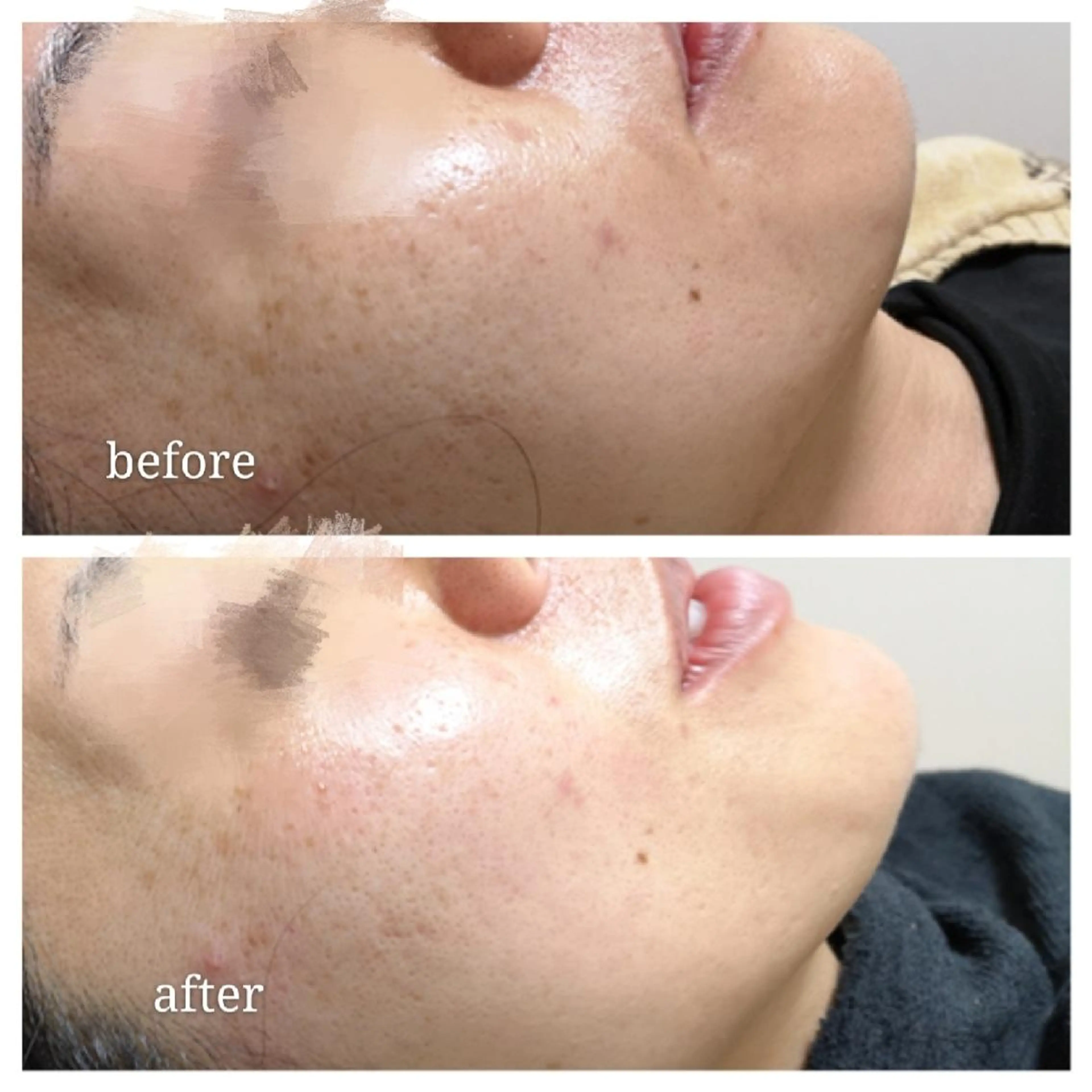 🅖🅤🅩🅔🅛 salonのエステ・リラクイメージ