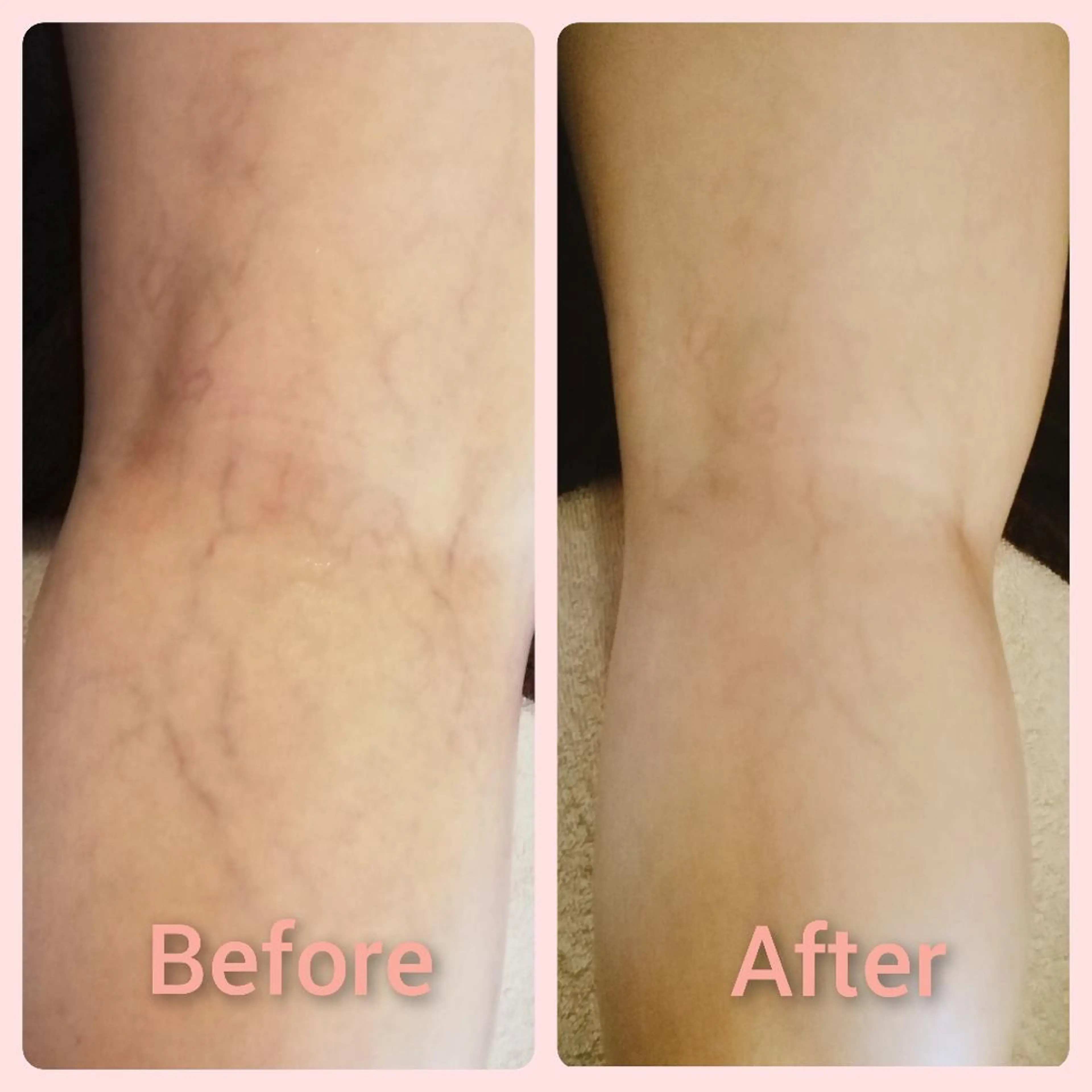 エステ リラク エステサロン　Lazulisea所属・川口 春奈のエステ・リラクイメージ