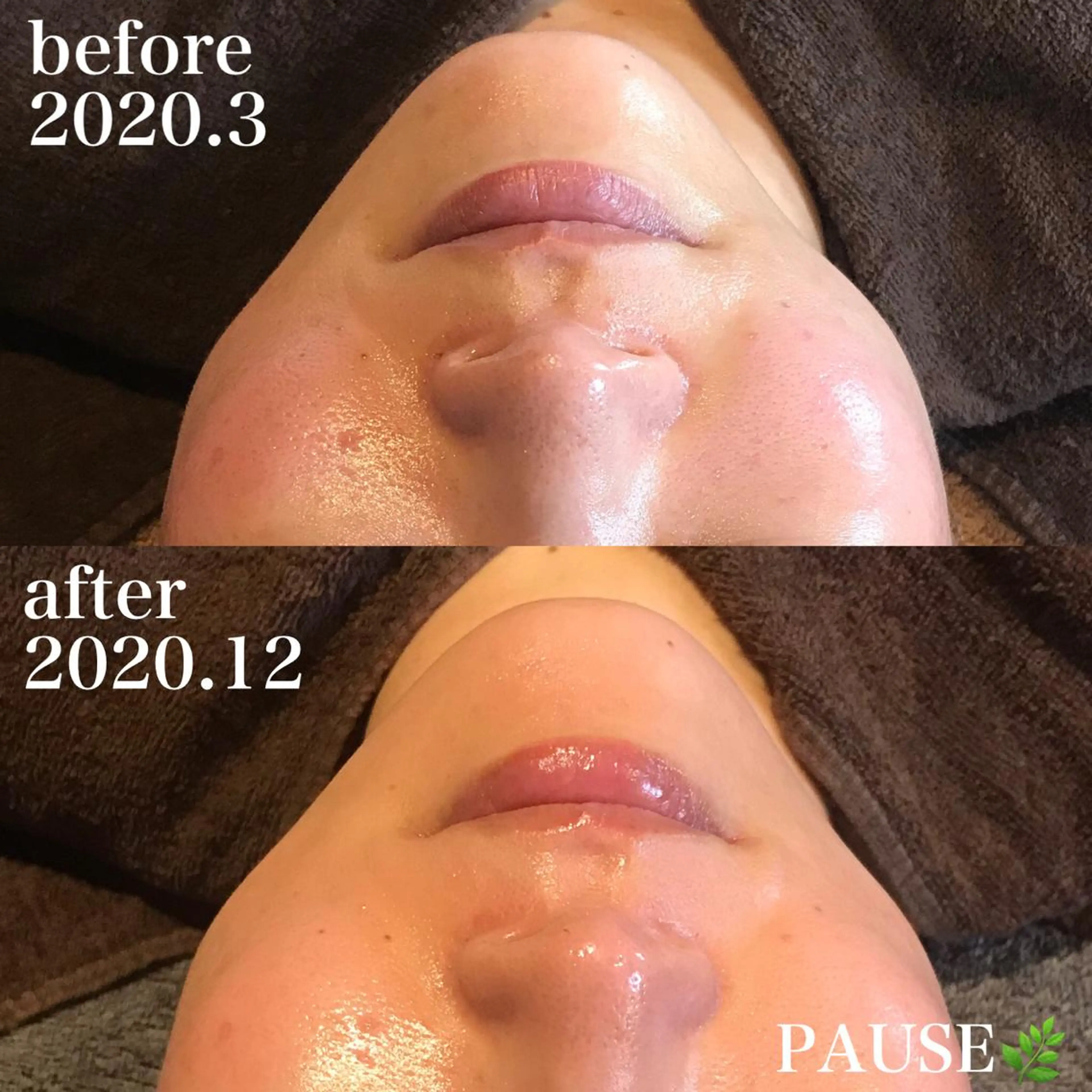 エステ 浜野 恵美のエステ・リラクイメージ