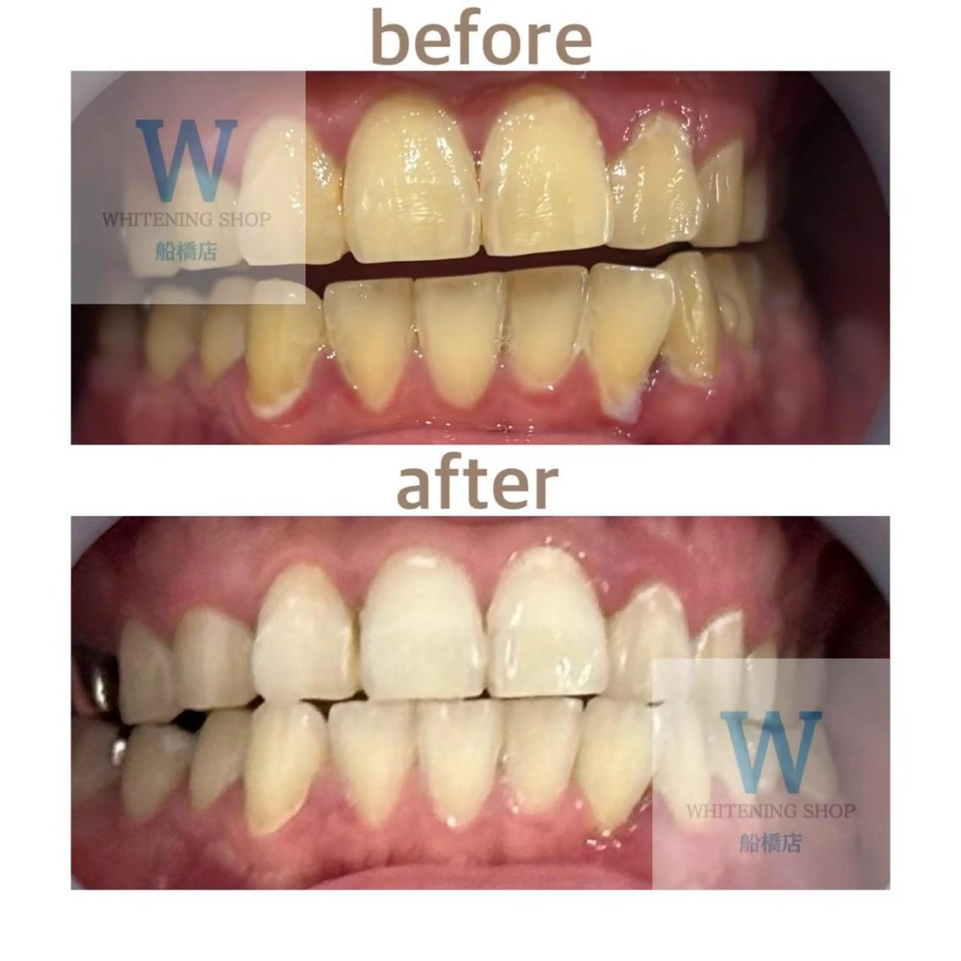 ホワイトニング ショップ船橋２号店のエステ・リラクイメージ