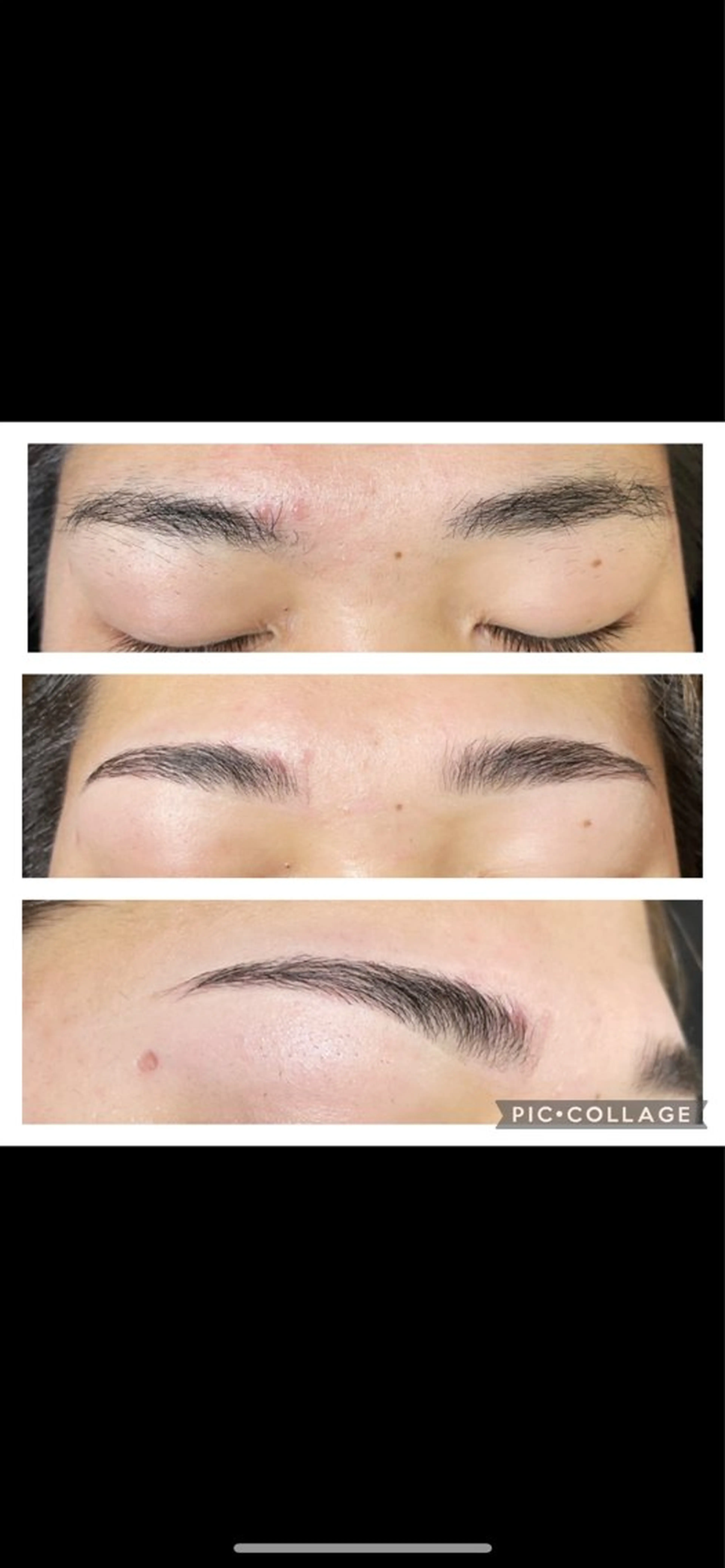 ワックス脱毛の写真