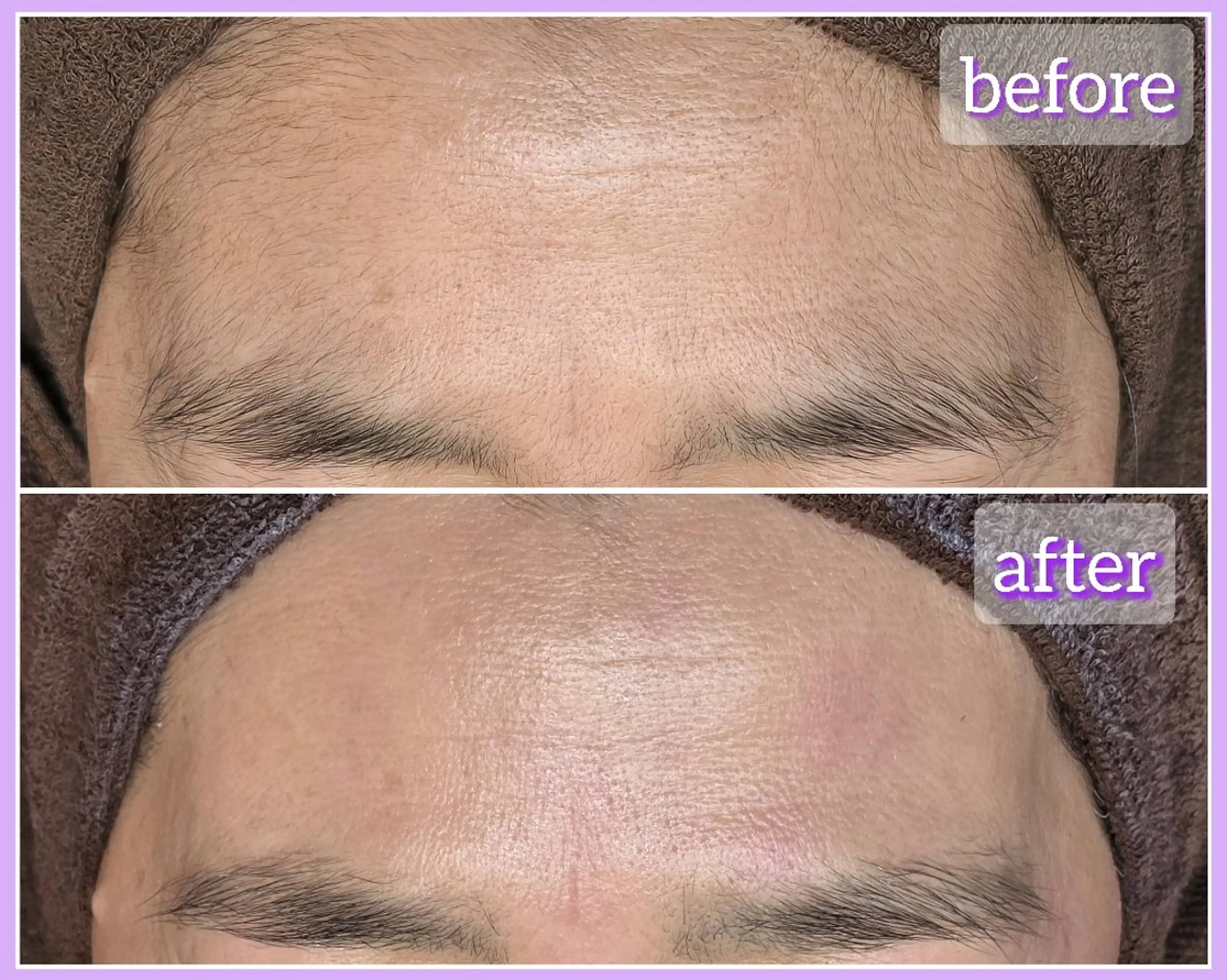 脱毛 facial salon Lily所属・salon Lilyのエステ・リラクイメージ