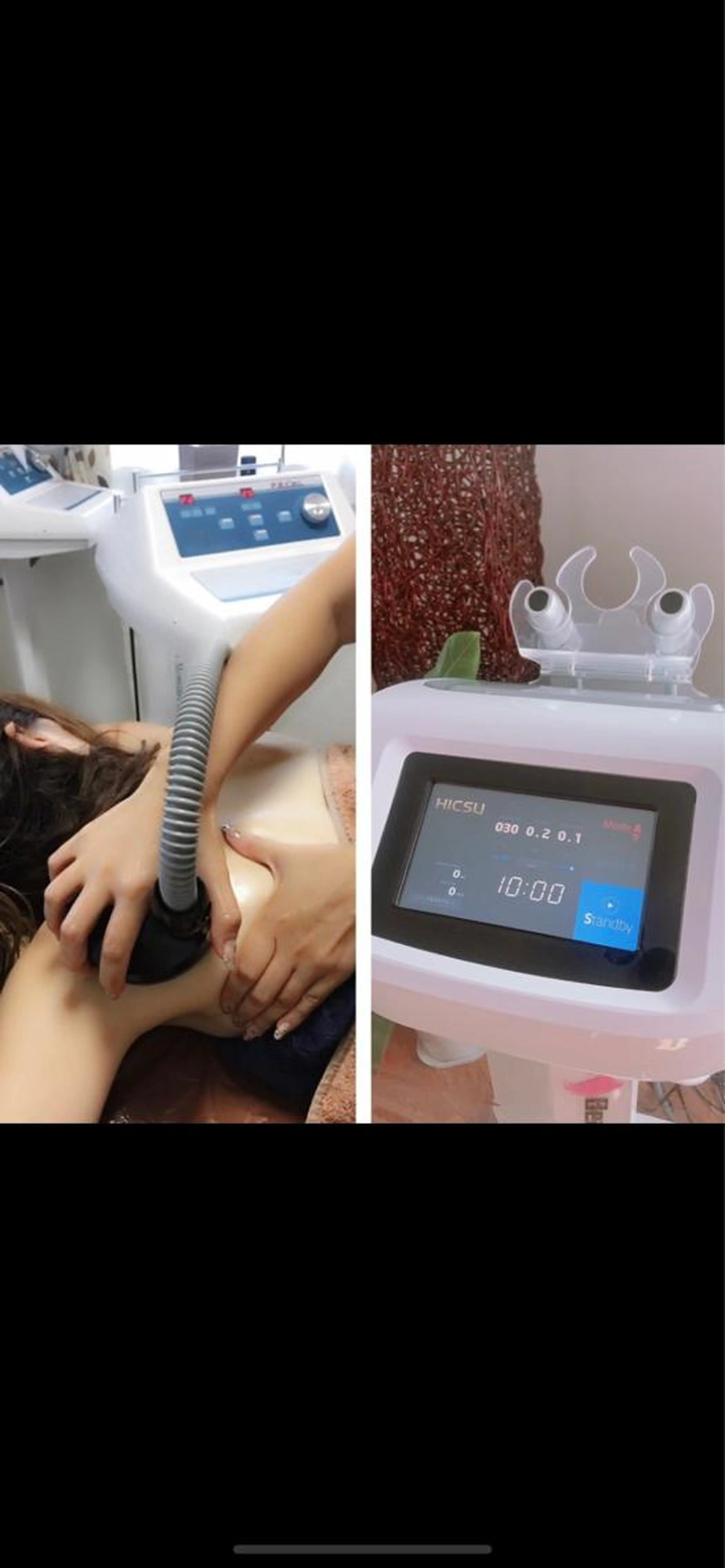 ⭐️三河初　ハイックス導入特別キャンペーン⭐️ 最強痩身　全身コース‼️直営店価格¥50000→¥13000の写真