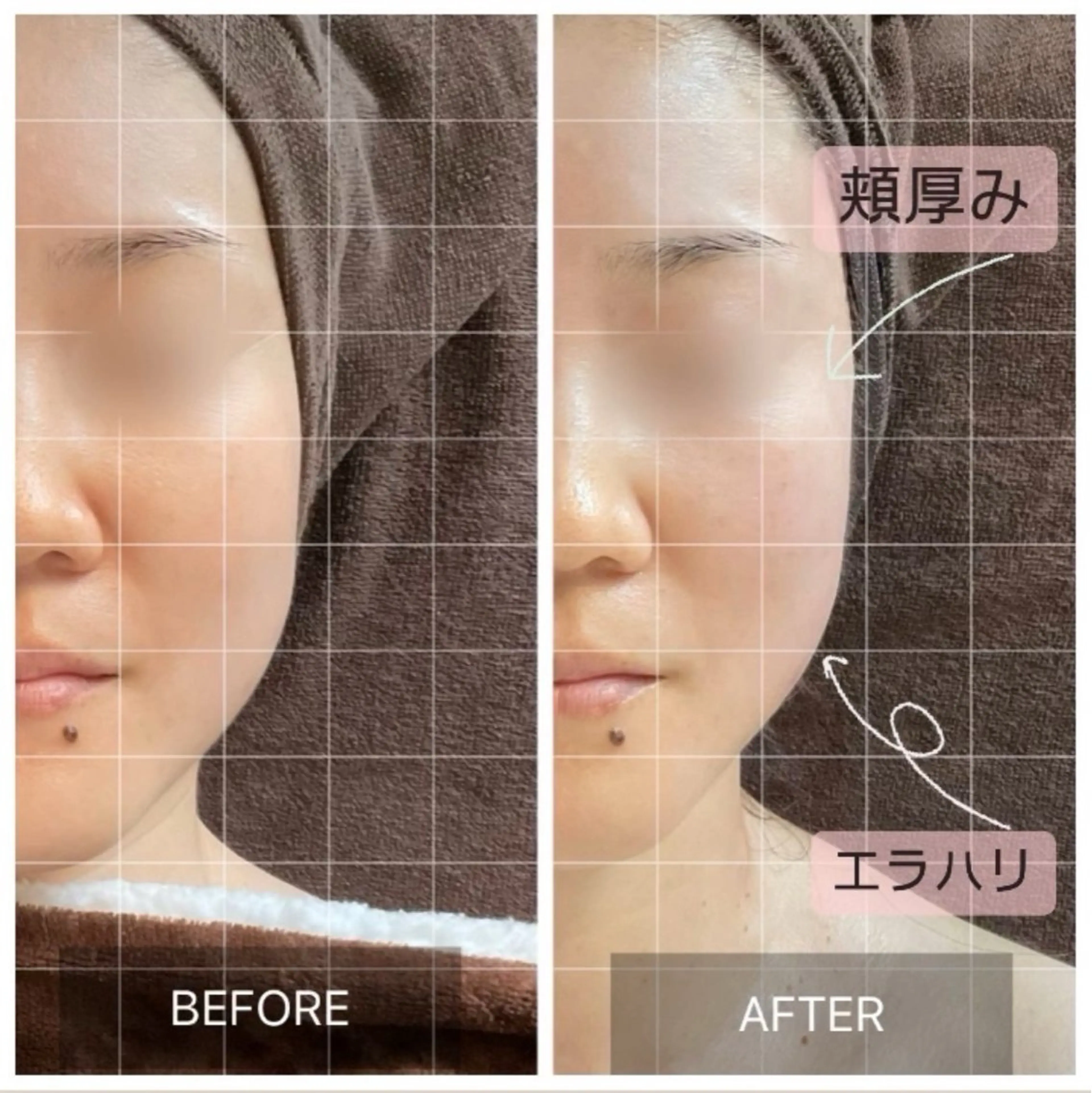 その他 MIRAI小顔 広島駅前店のエステ・リラクイメージ