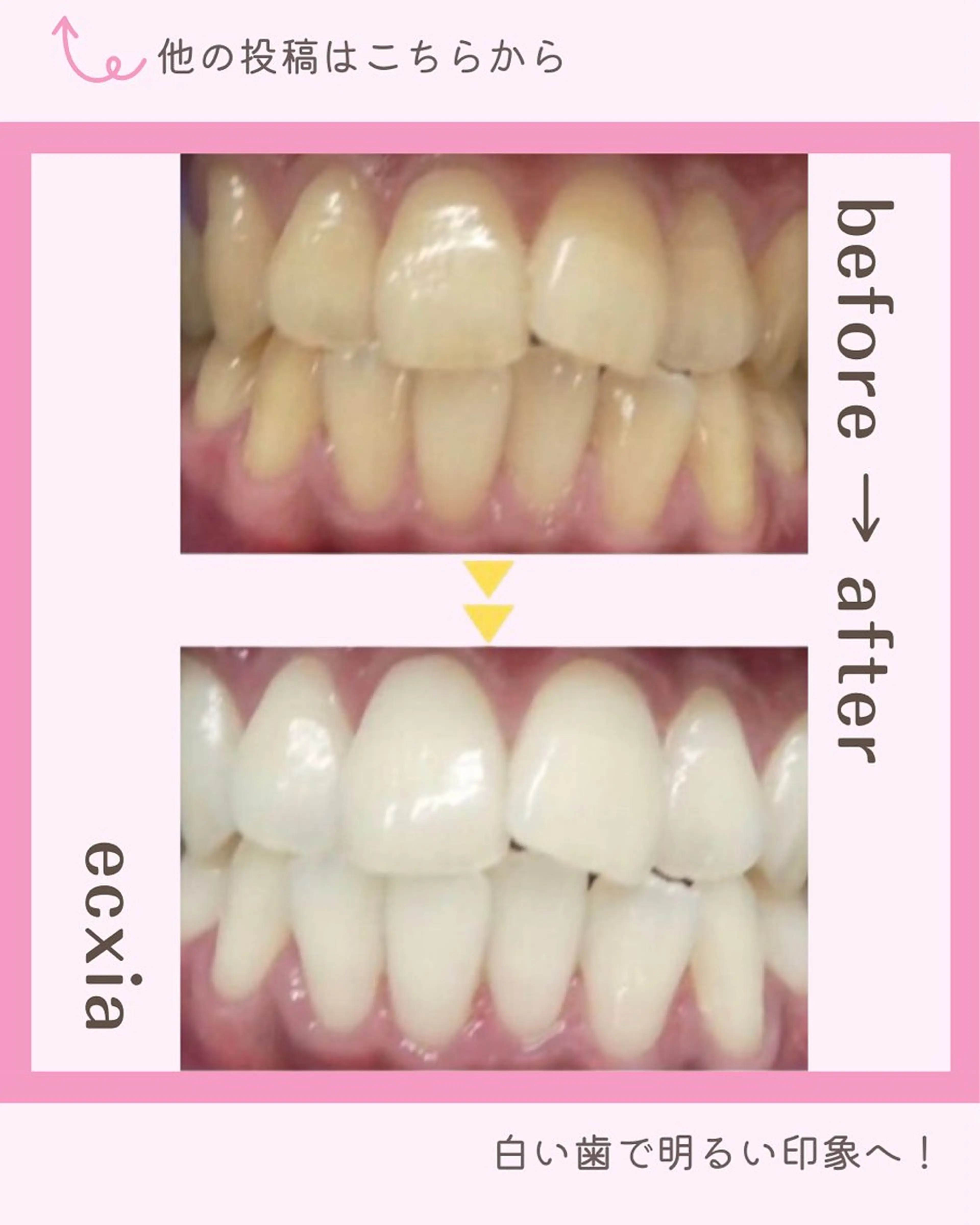 その他 ホワイトニング/脱毛 専門店エクシア岡崎店のその他イメージ