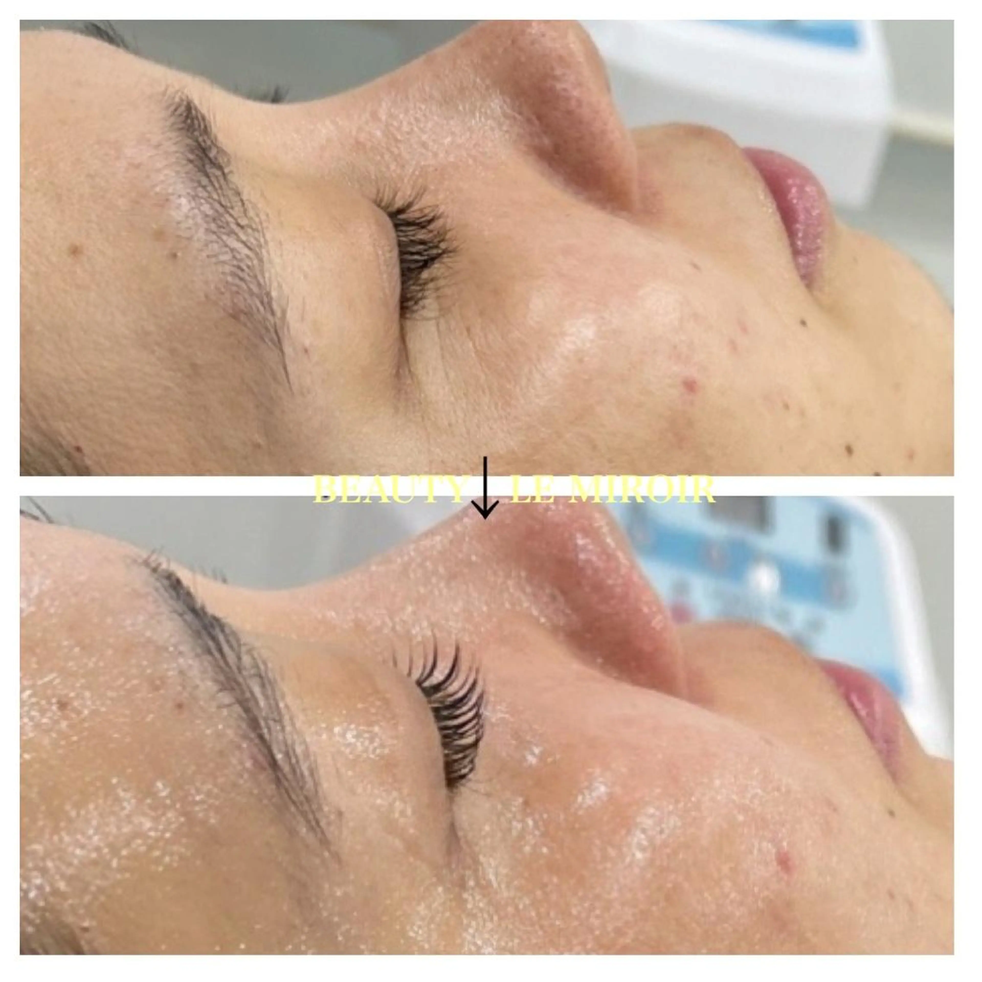 ビューティー ミロワールのエステ・リラクイメージ