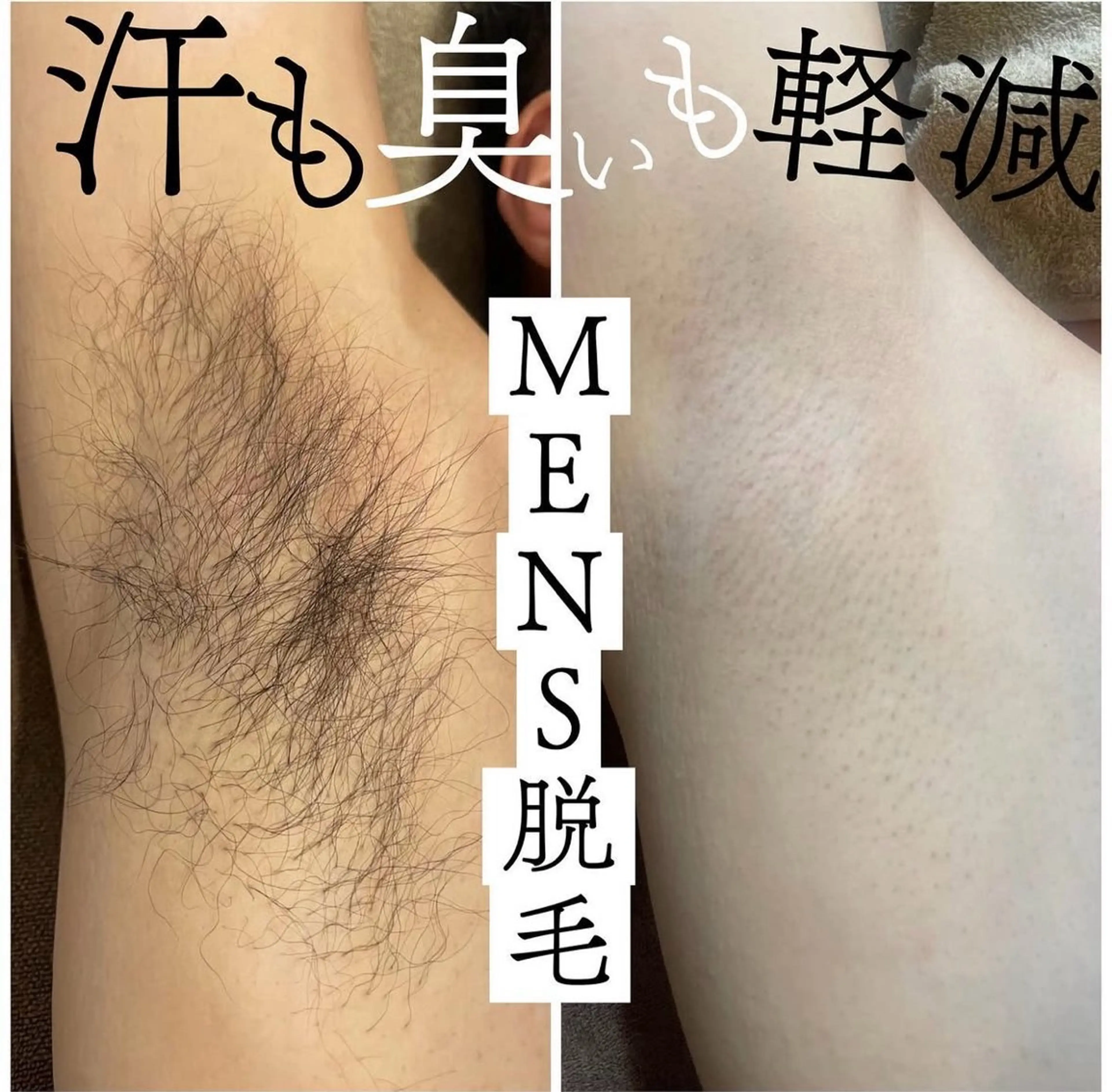 メンズ 脱毛 茶谷 梨紗のエステ・リラクイメージ