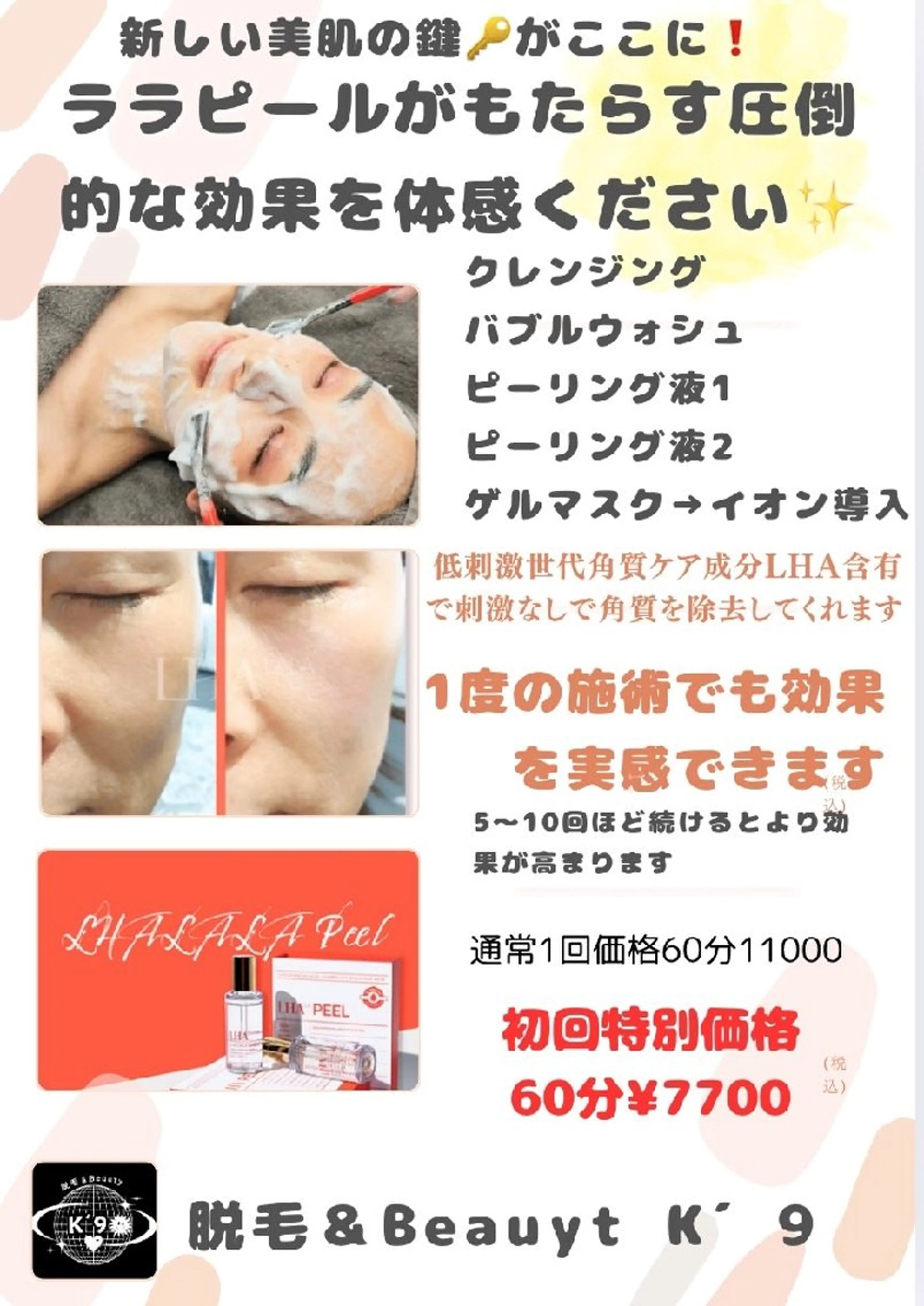 メンズ　ララピール　初回来店30%OFFの写真