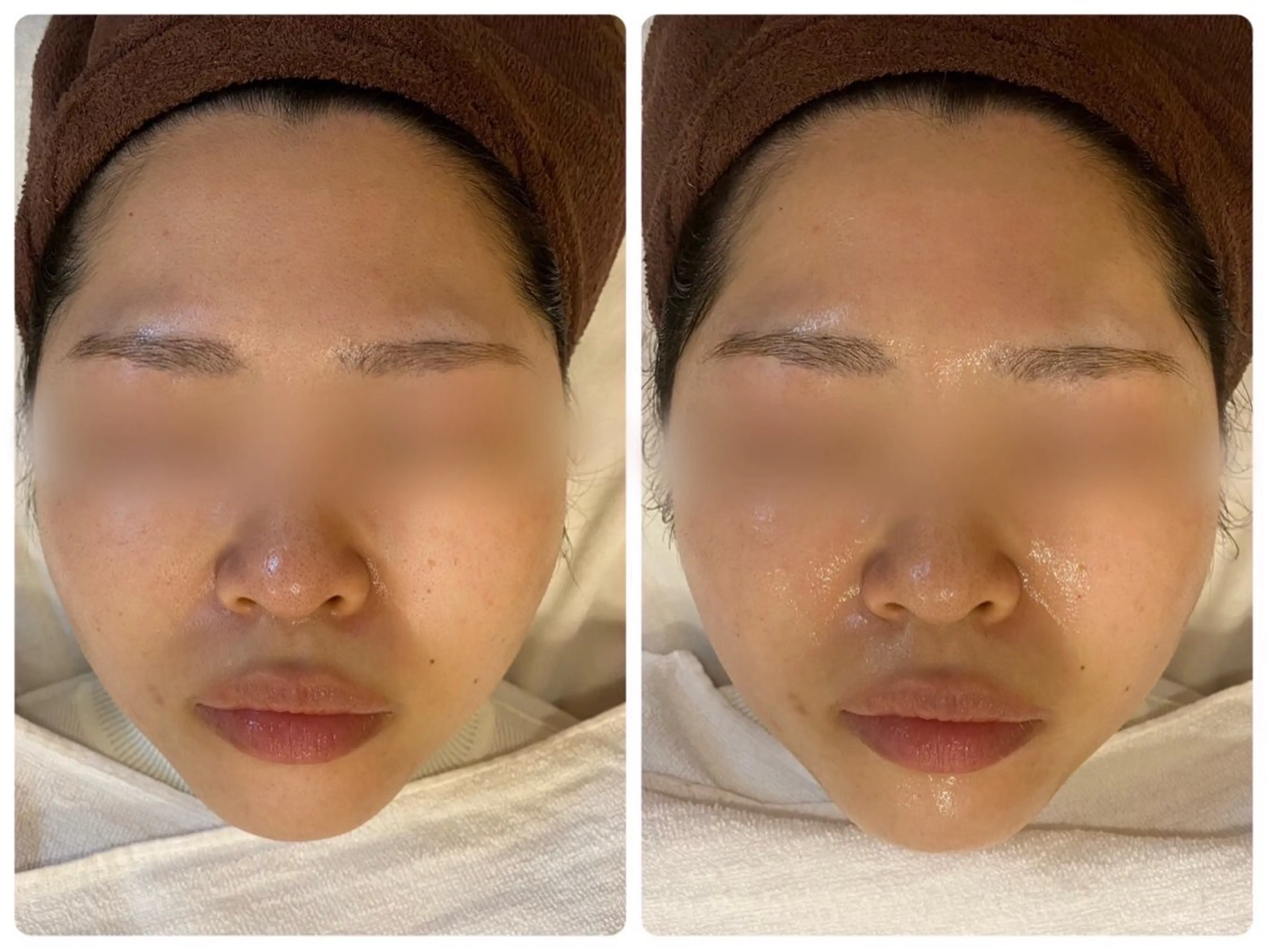 ハーブピーリング🌿 脱毛🧡ヘッドスパのエステ・リラクイメージ