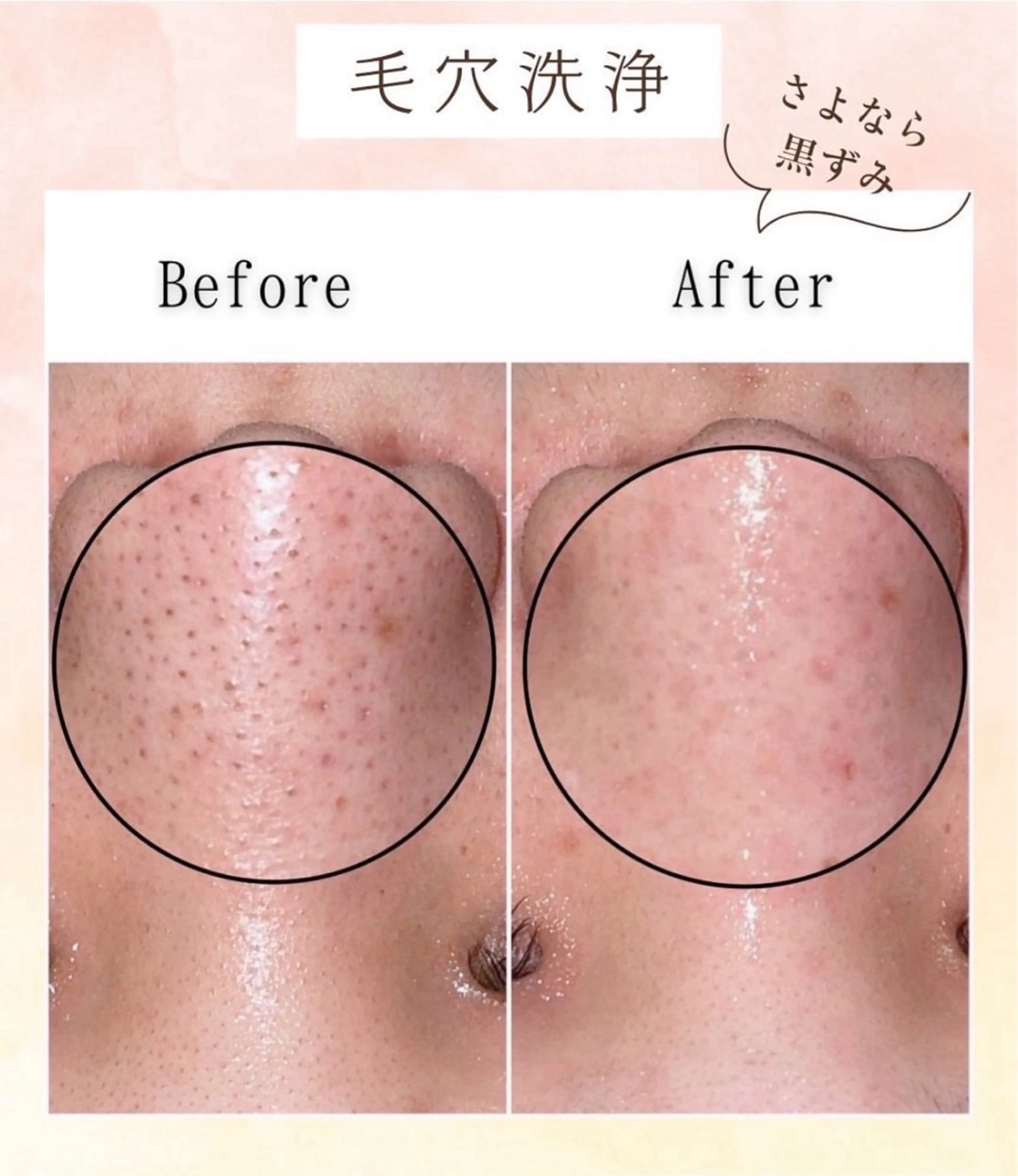 ㊗️成人  フラットラッシュ120本+毛穴洗浄🫧の写真