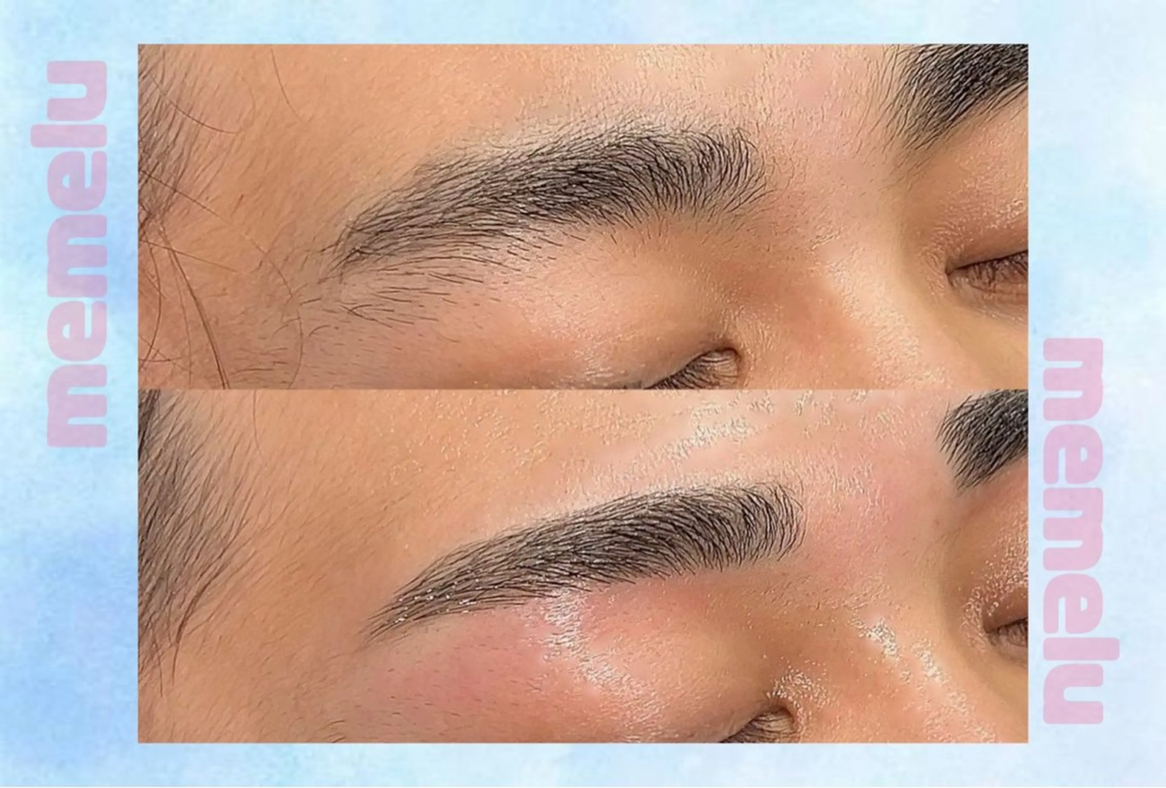 🌱🦔メンズWAX脱毛🦔🌱の写真