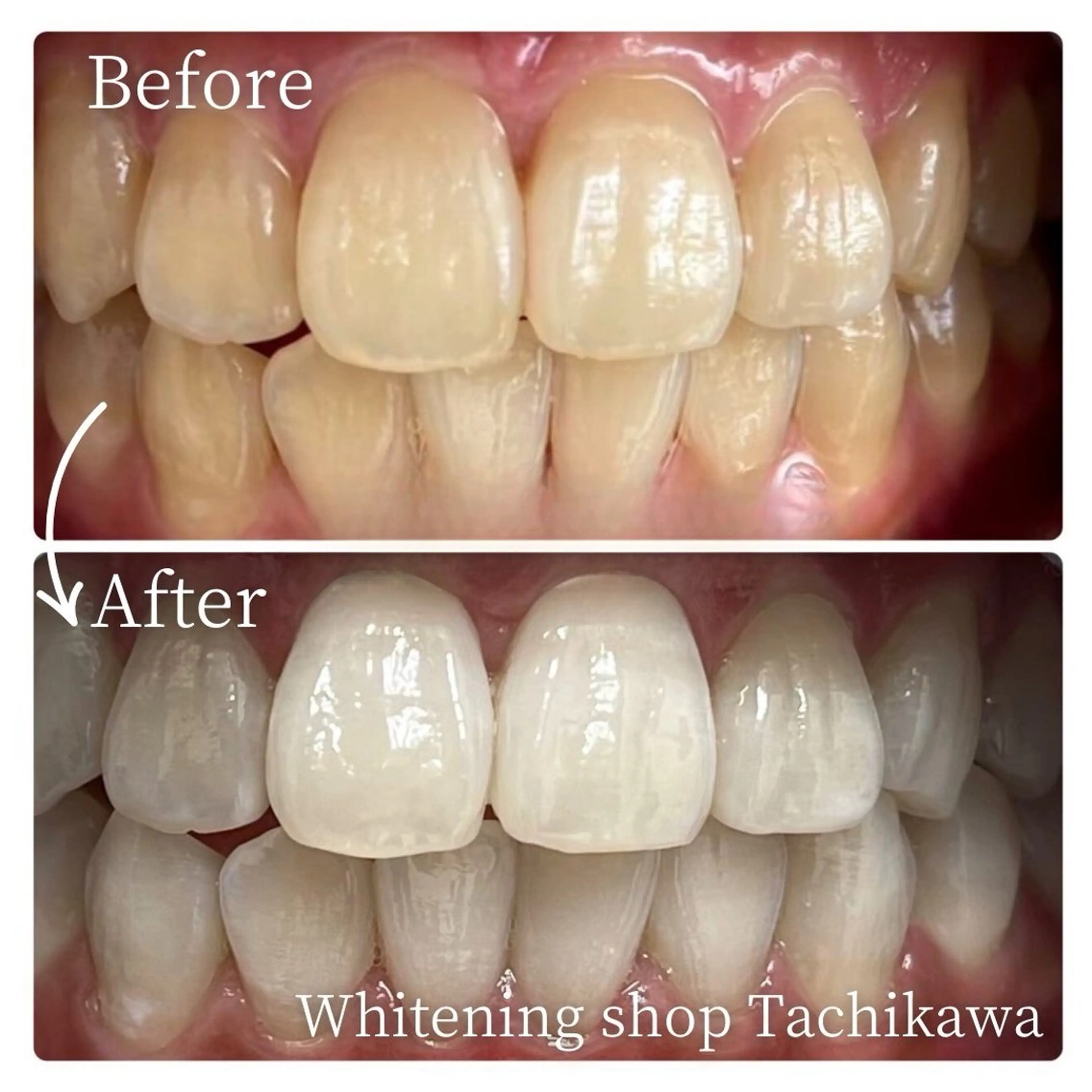 セルフ　ホワイト ニングショップ立川のその他イメージ