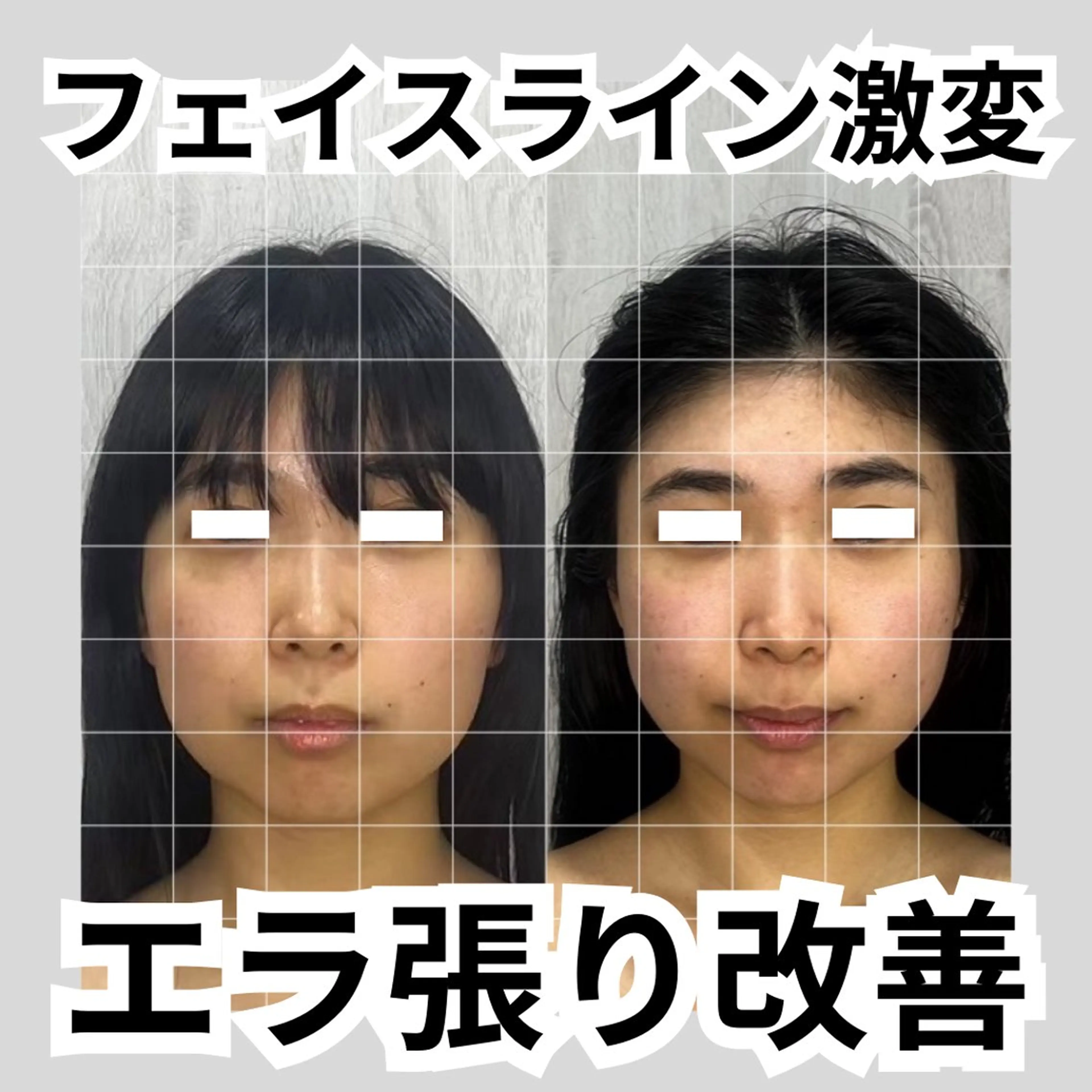 第一印象専門サロン ADISEのエステ・リラクイメージ