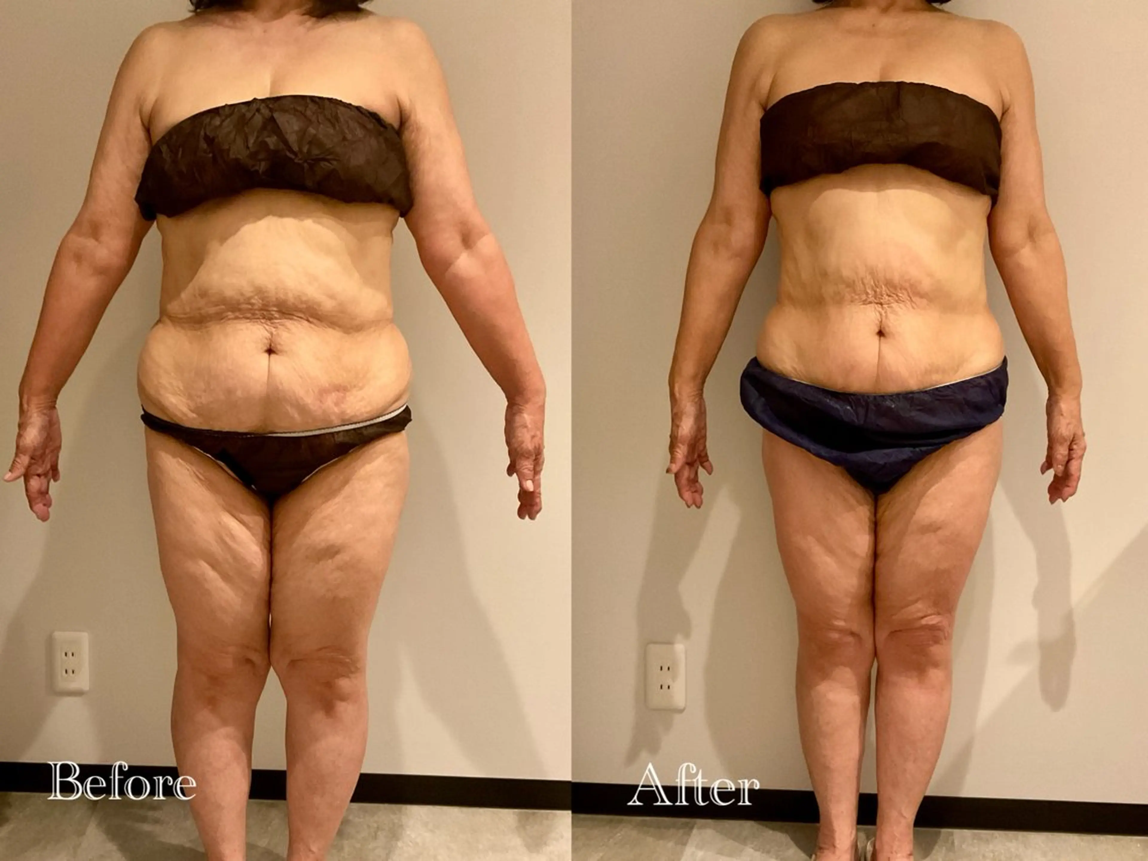 Esthetic MiEUXのエステ・リラクイメージ