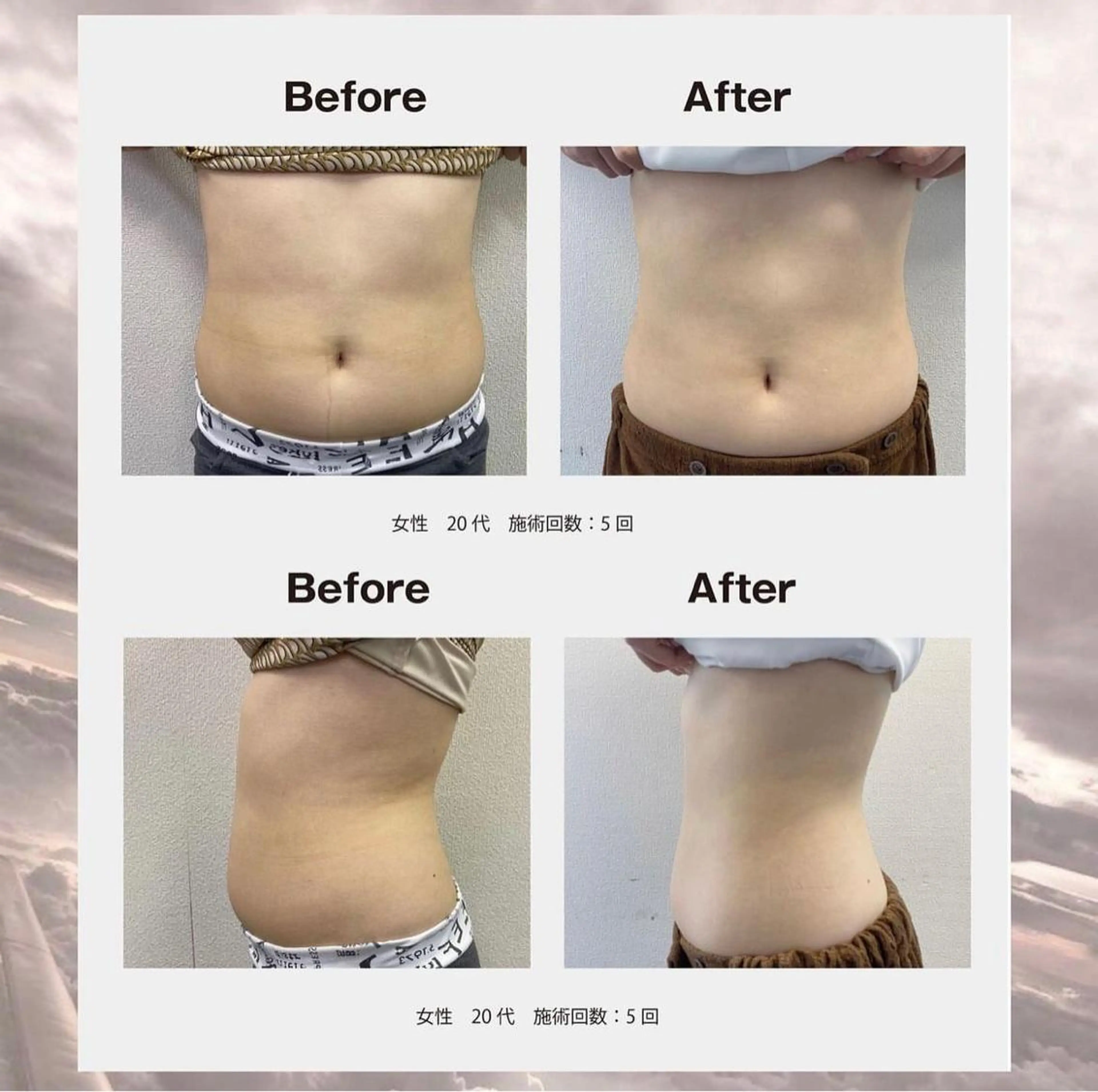 エステ 🦋美肌サロン. maho🦋のエステ・リラクイメージ