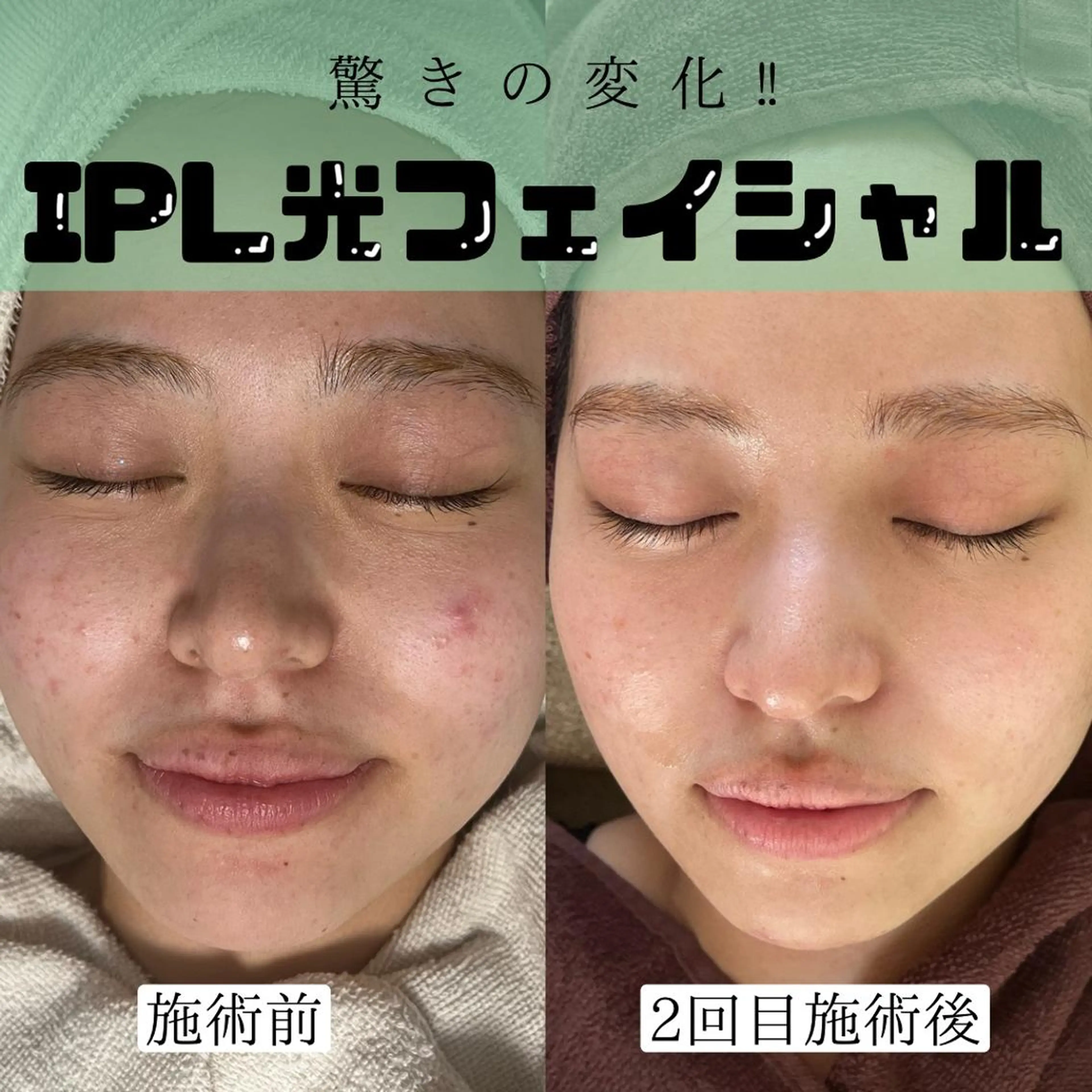 Rafre所属・Rafre【ラフレ】 タカヤマのマツエク・マツパデザイン